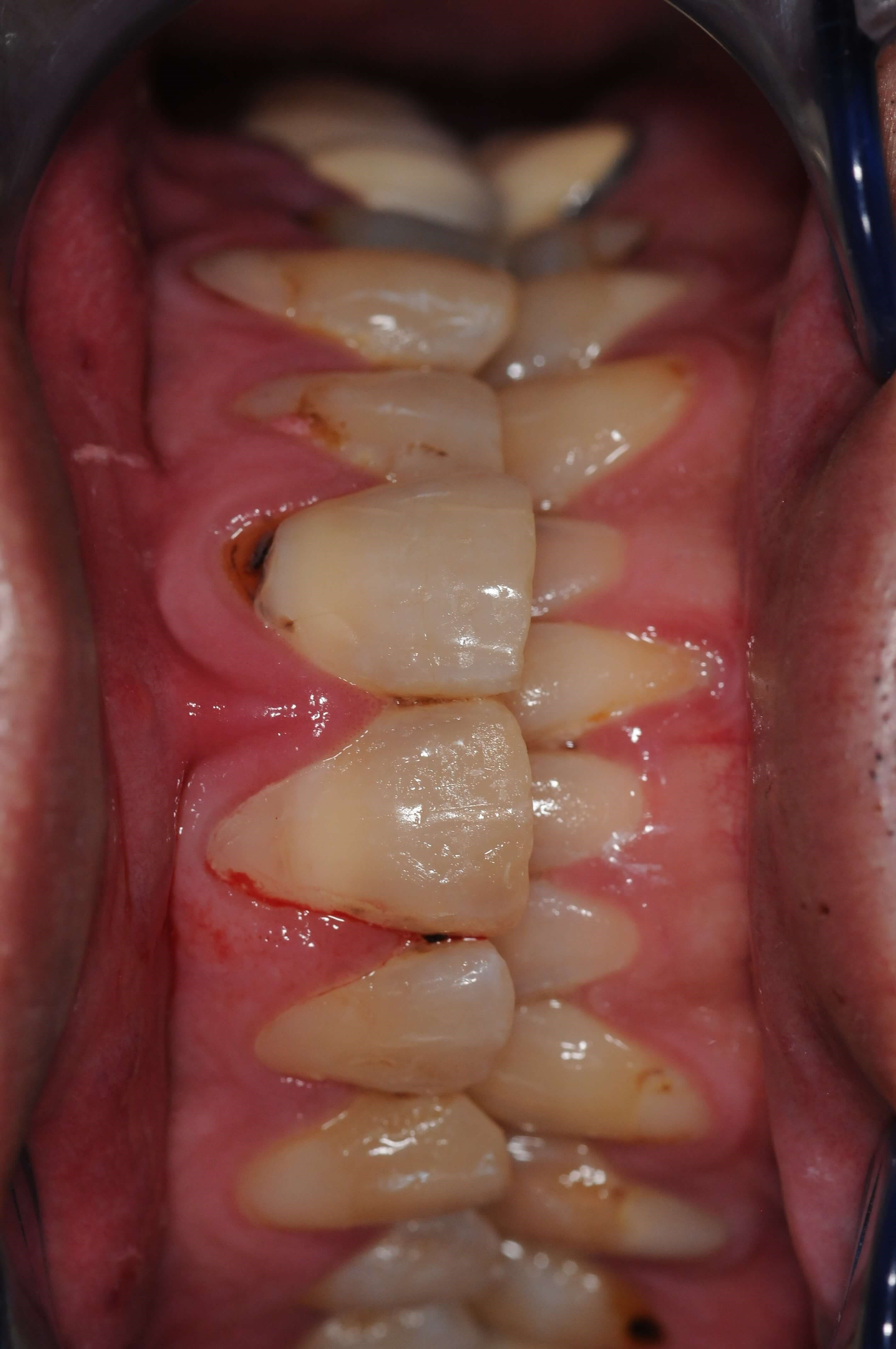 Before Image