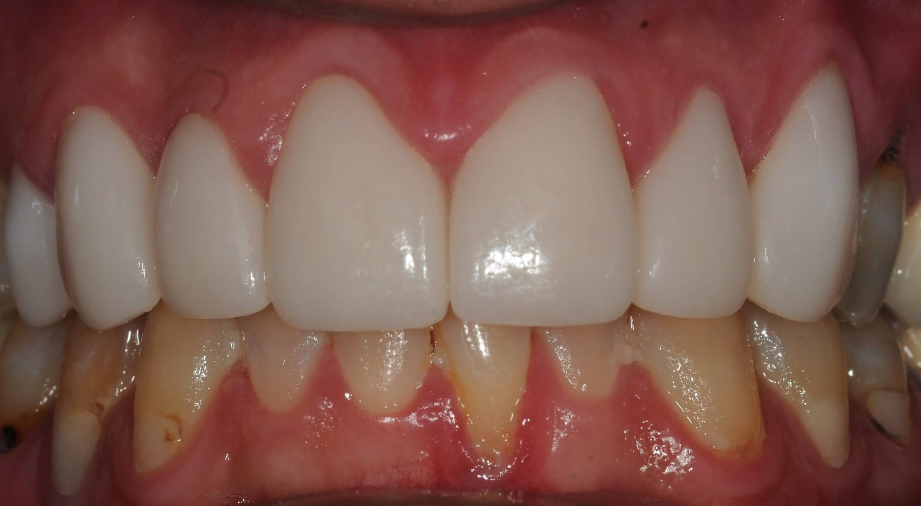 After Image