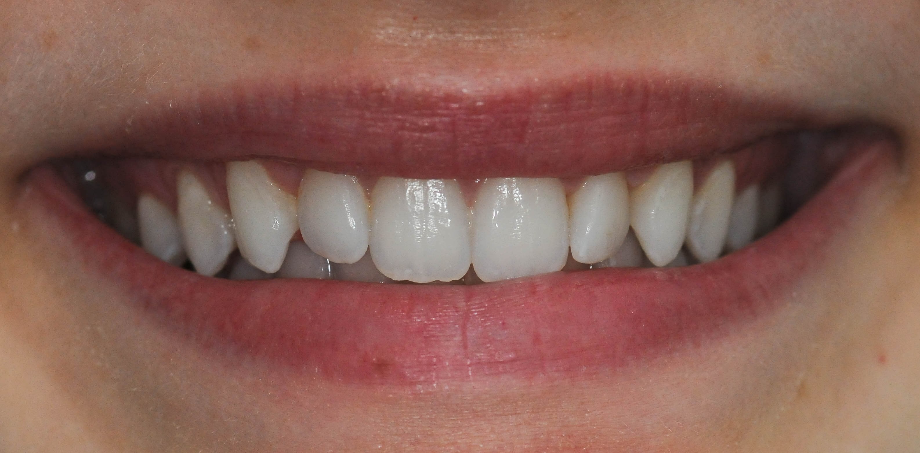 Before Image
