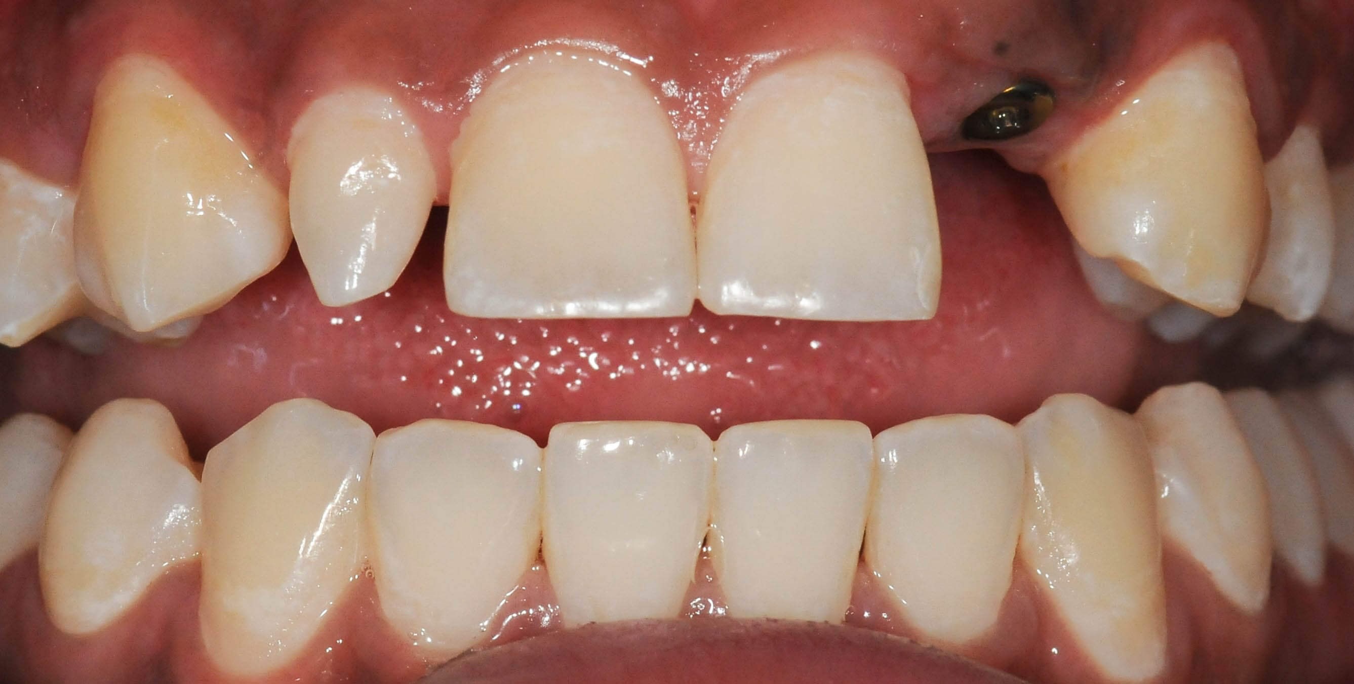 Before Image