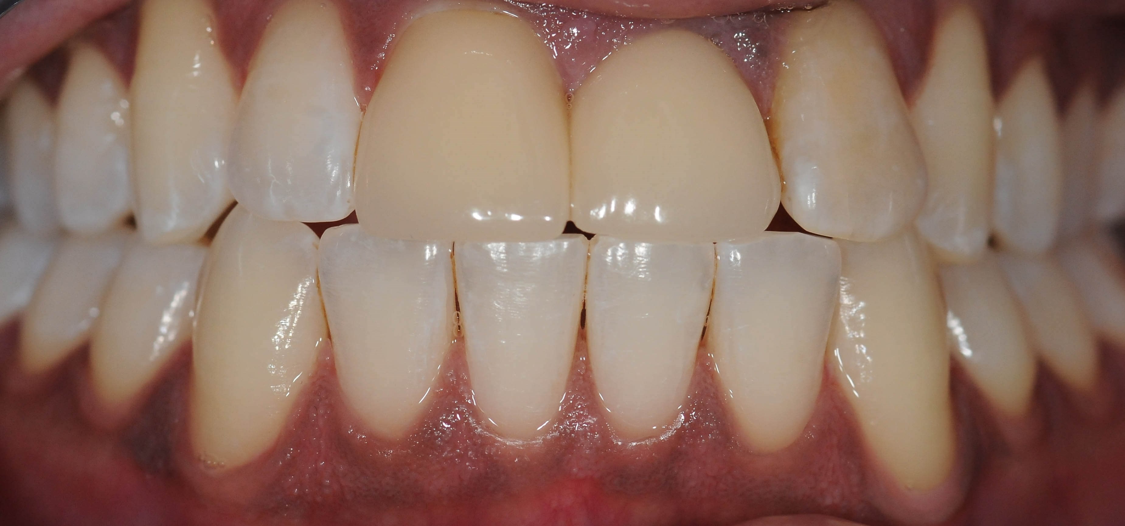 Before Image