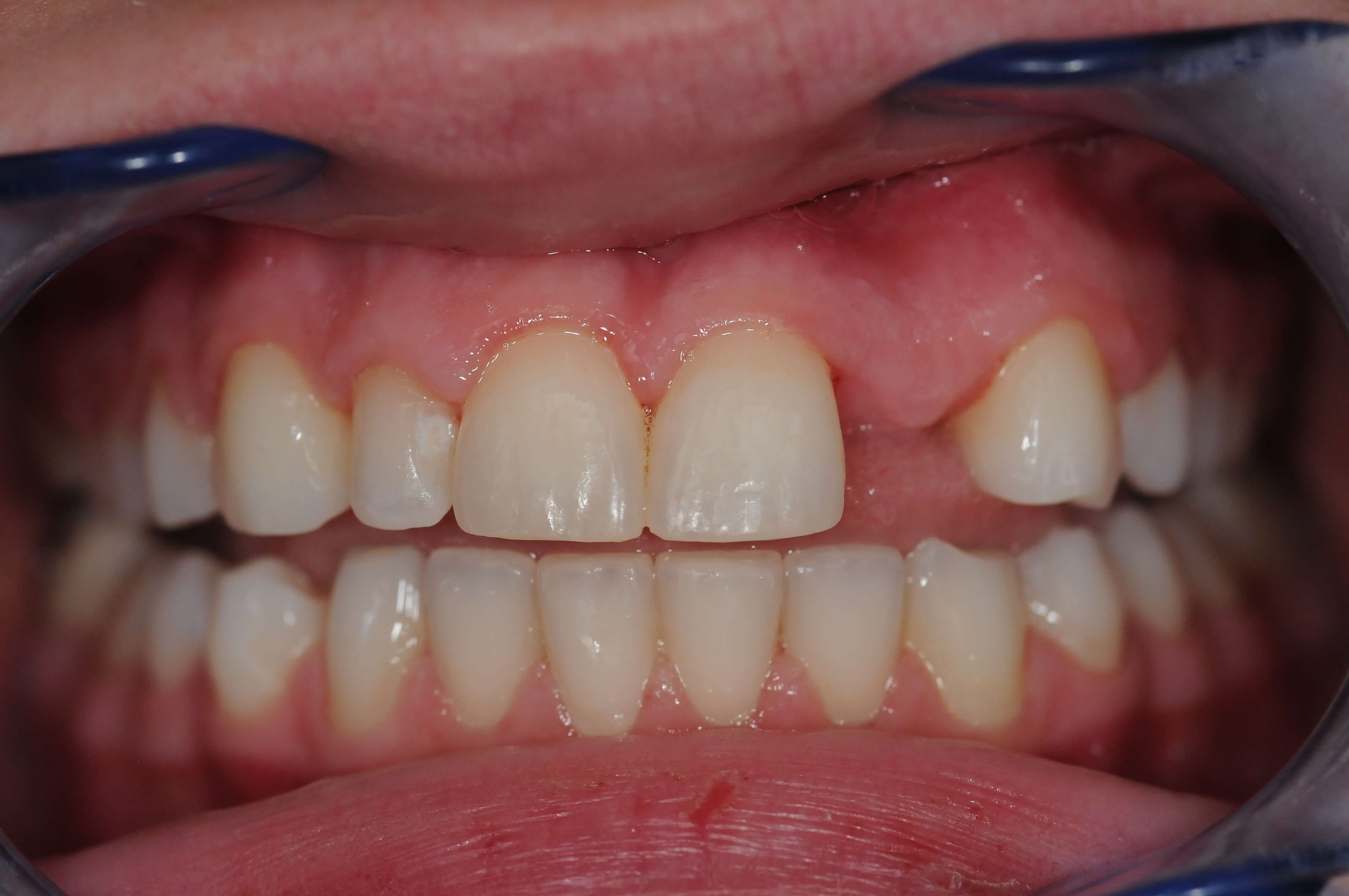 Before Image
