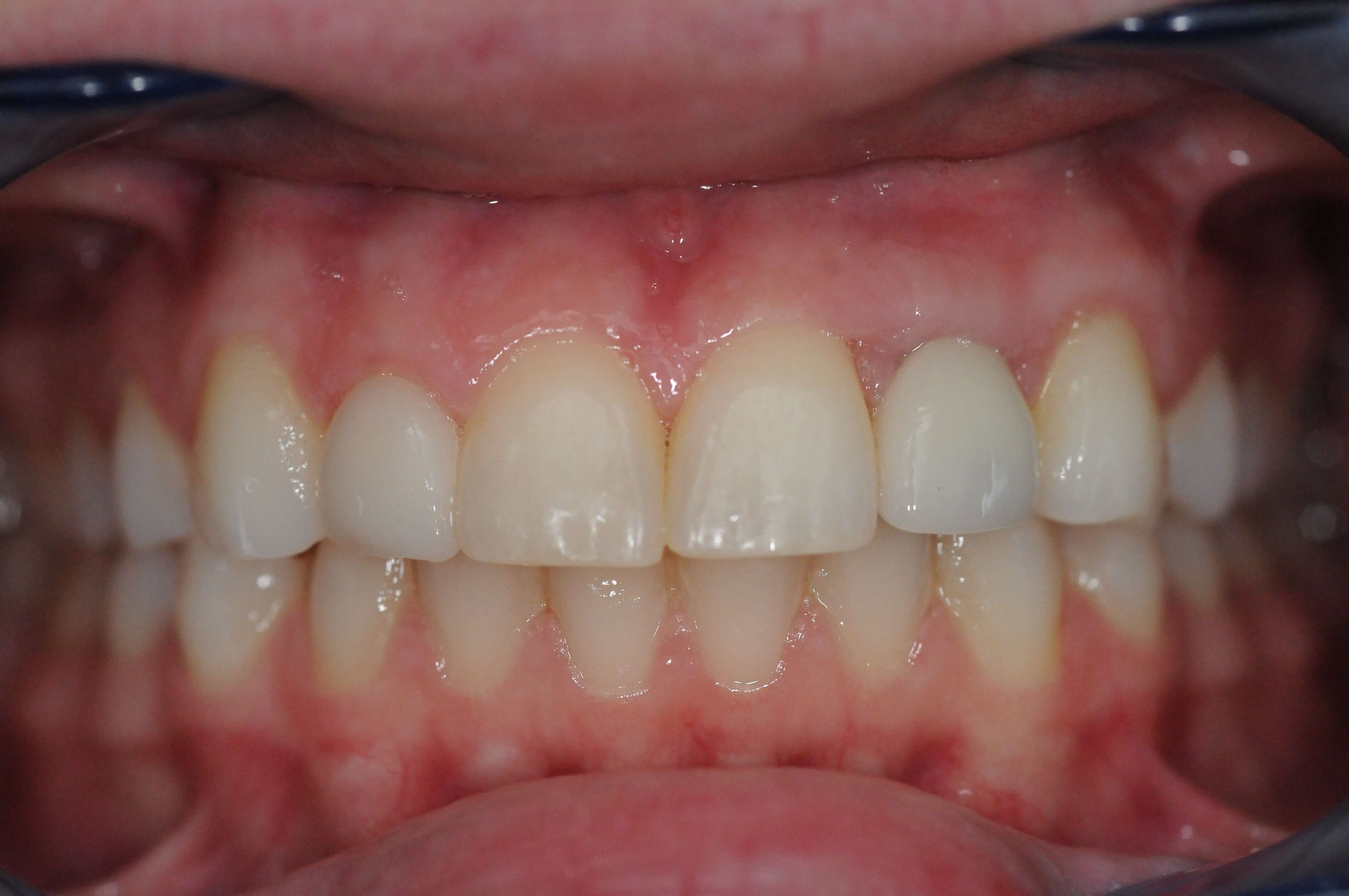 After Image