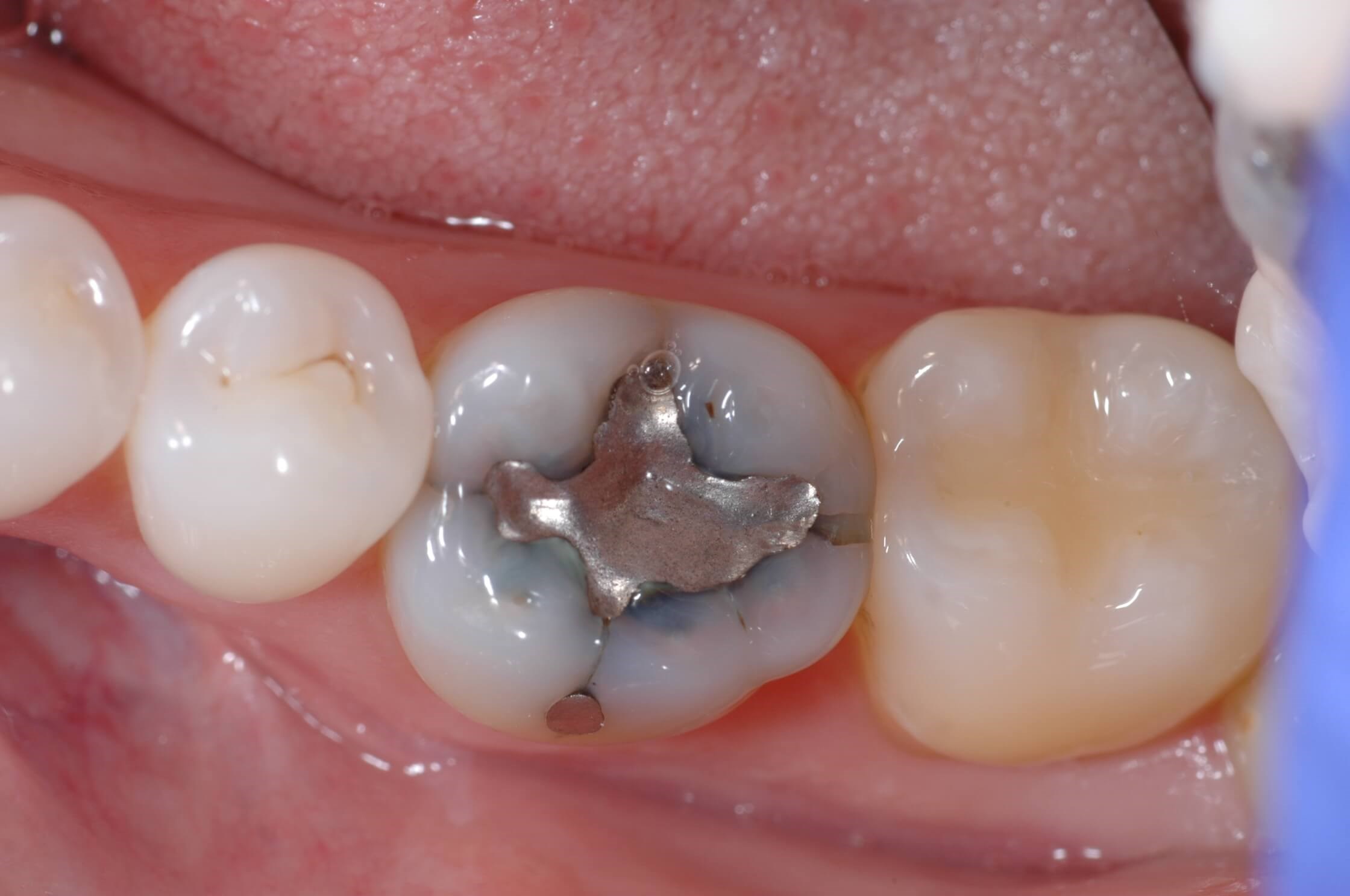 Before Image