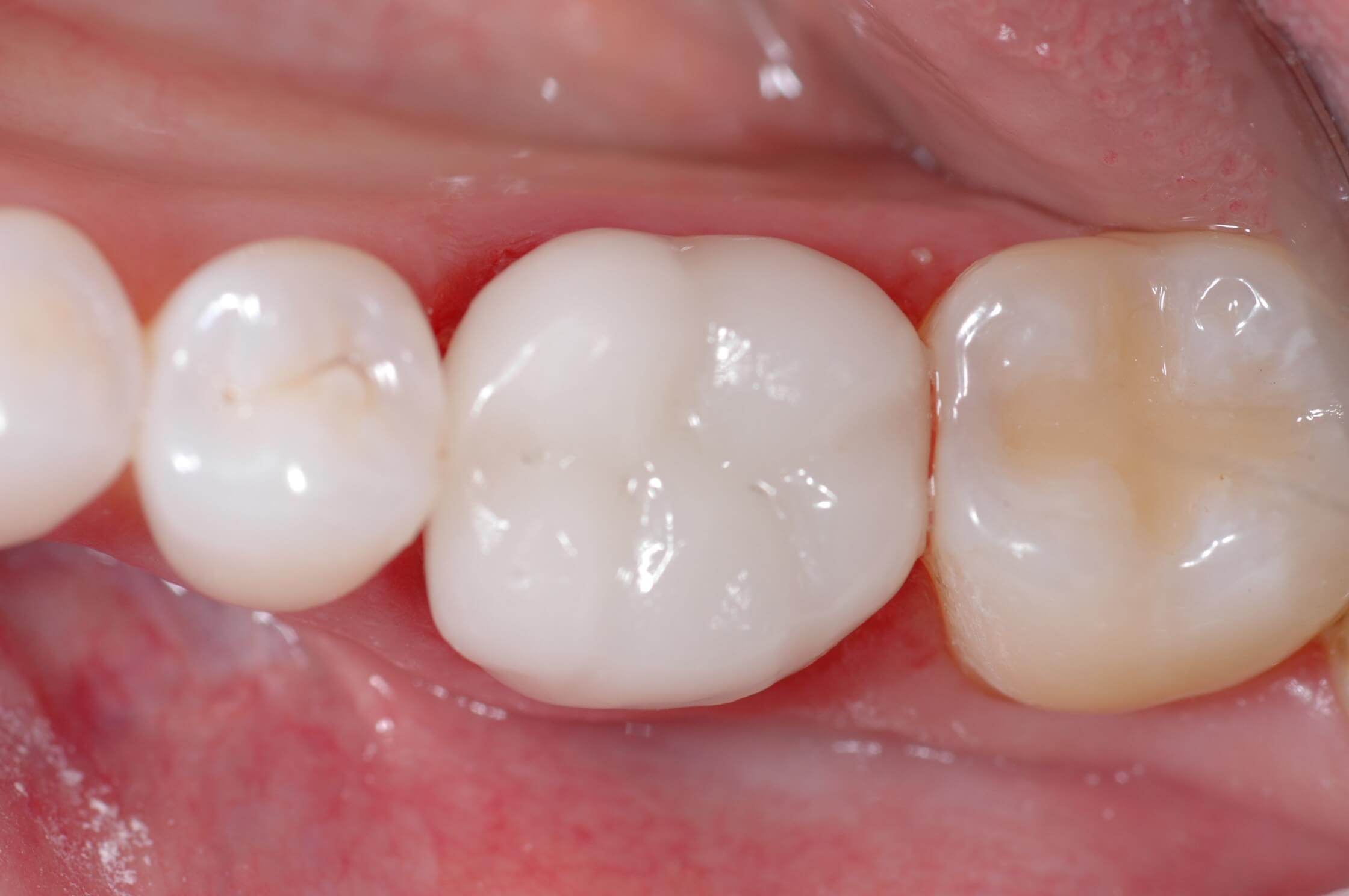 After Image