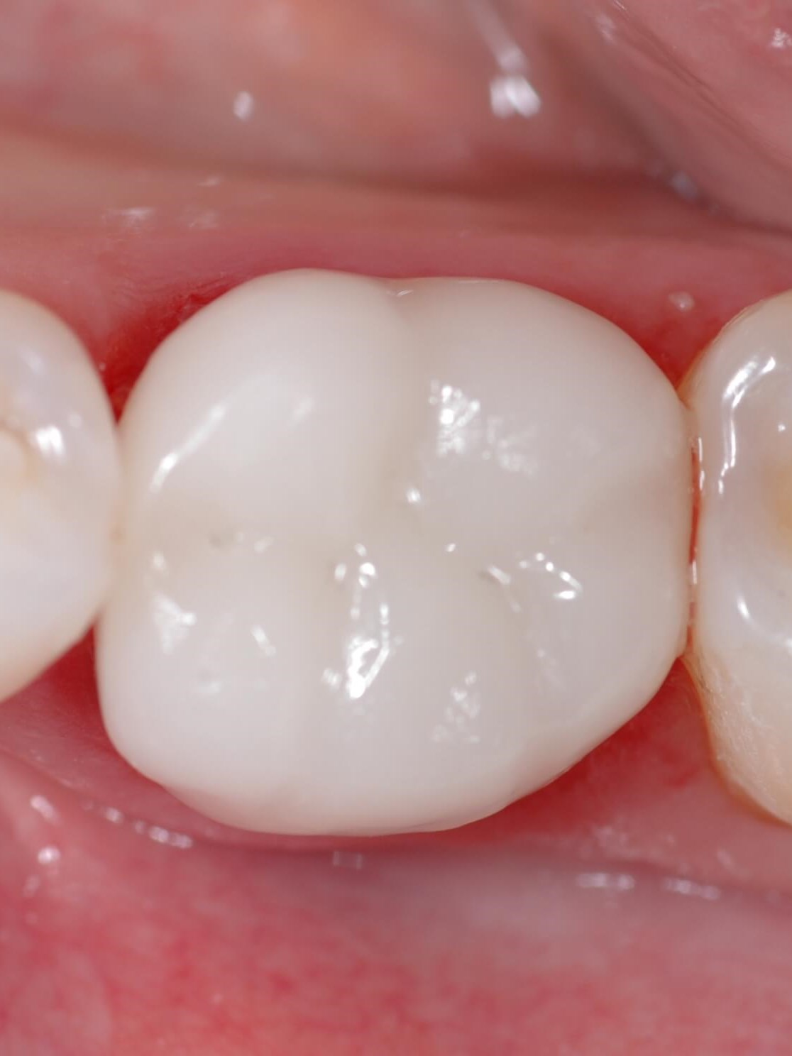 Dental Technology Is Amazing! After