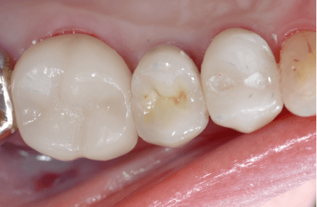 After Image