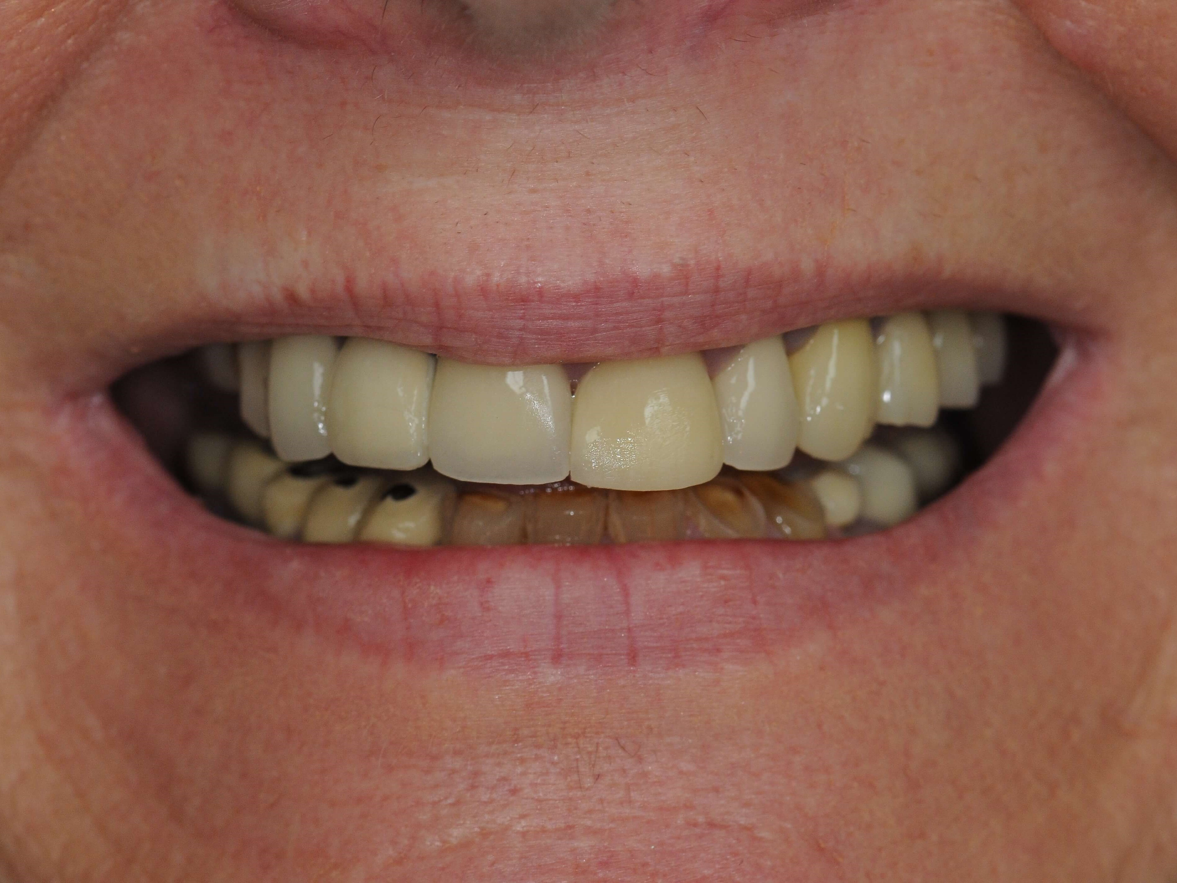 Closer View Before