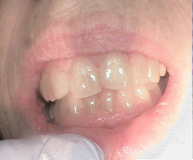 Before Image
