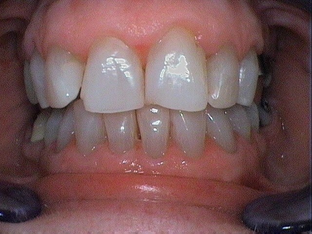 After Image