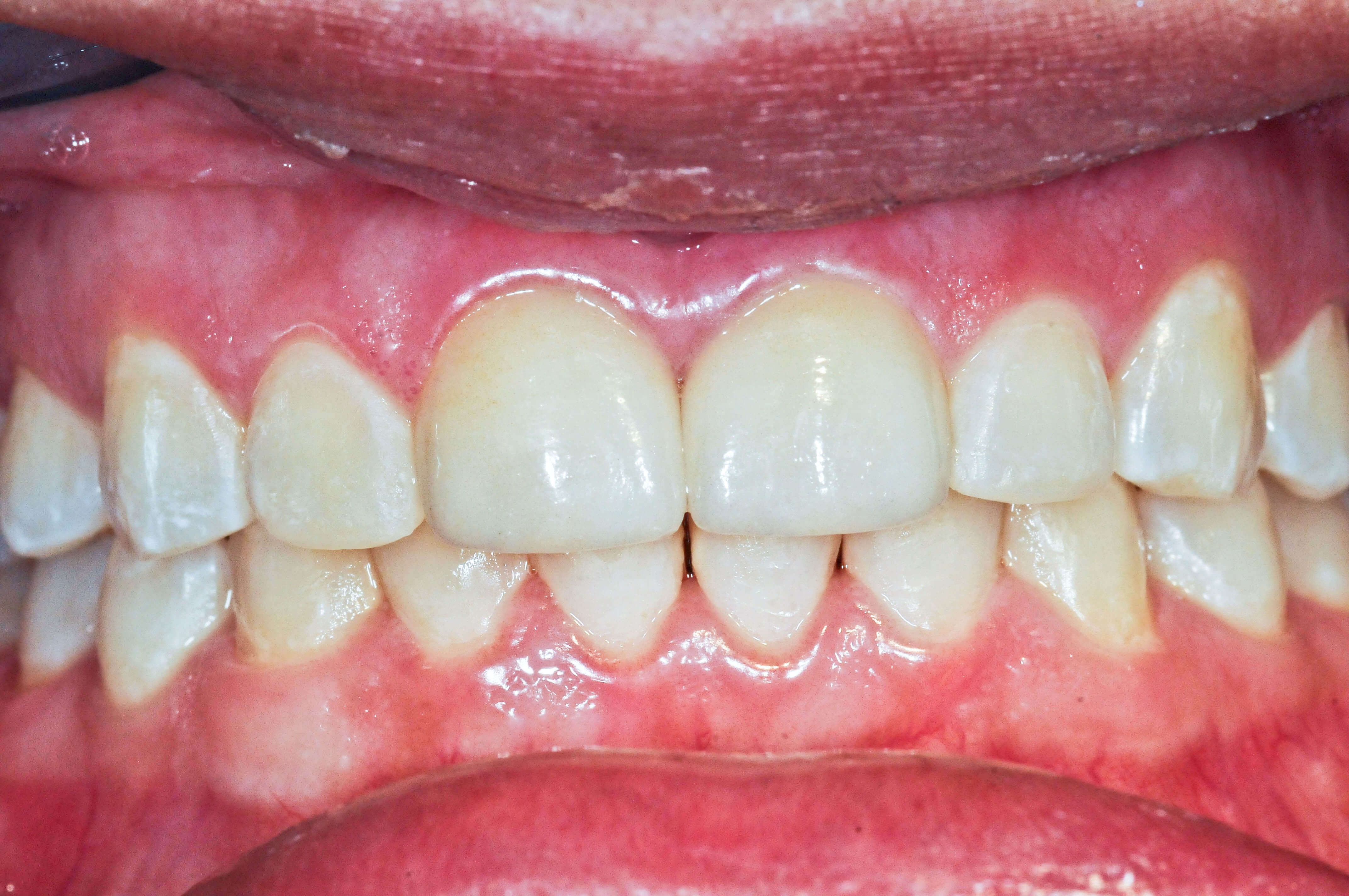 After Image