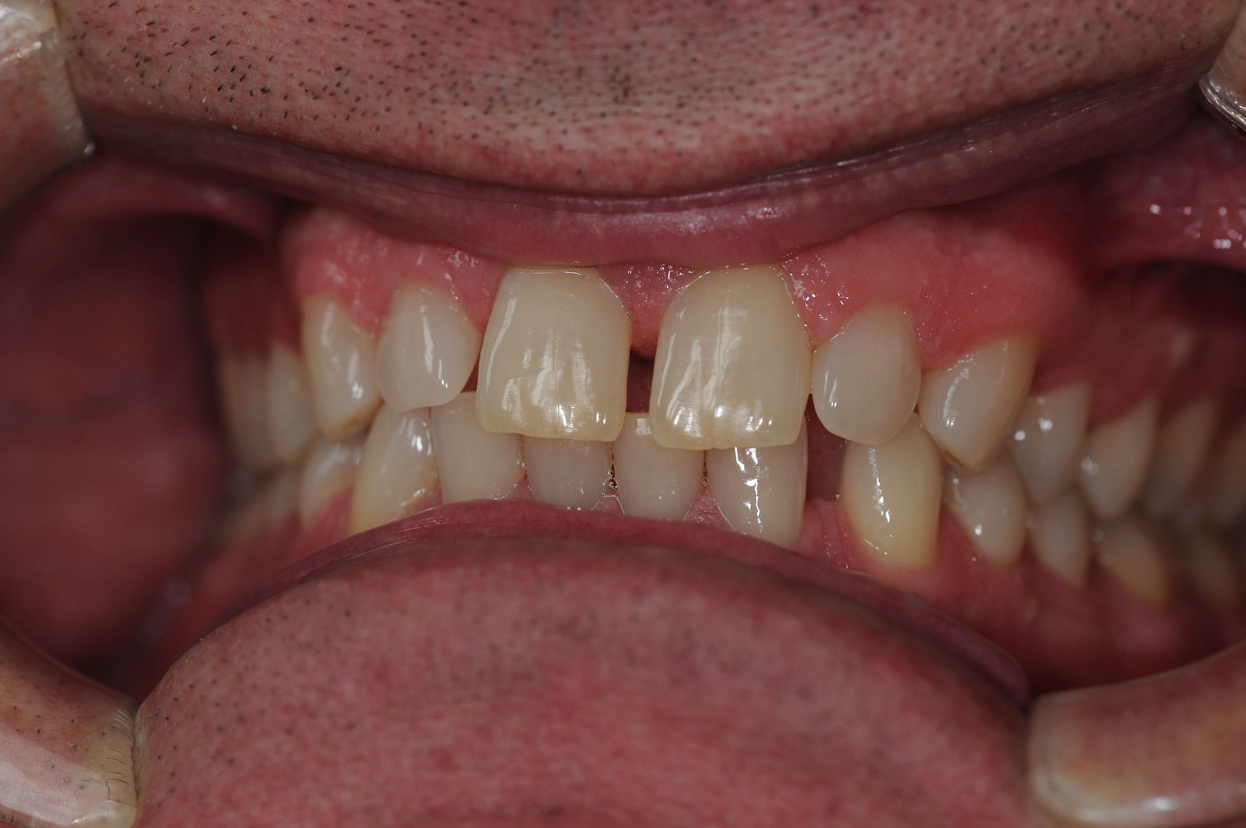 Before Image