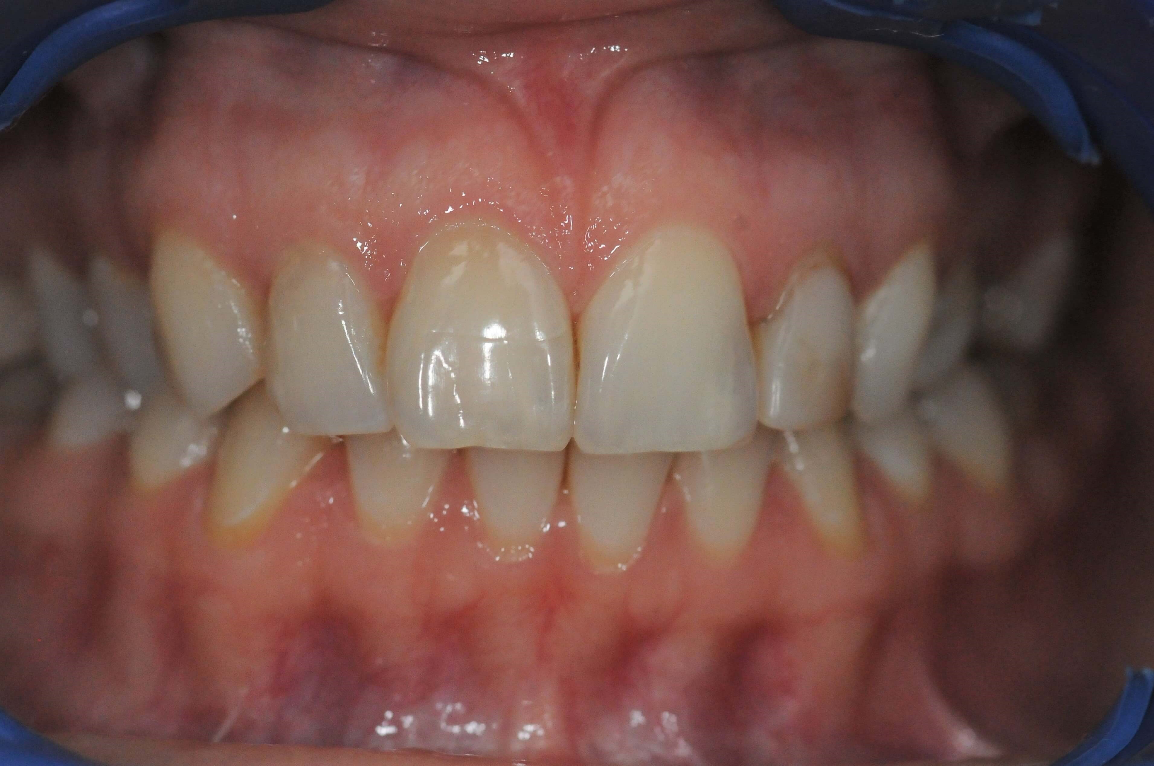 Before Image