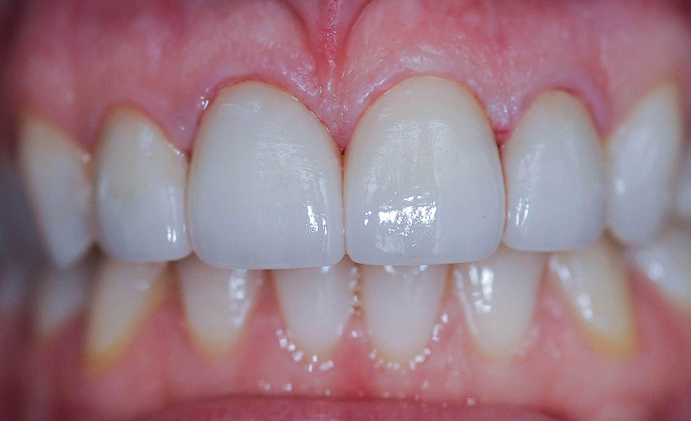 After Image