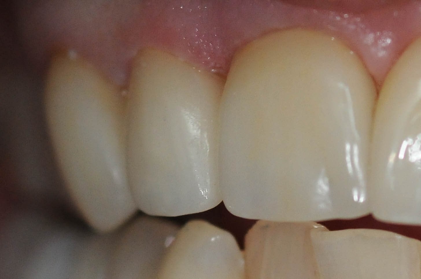 After Image