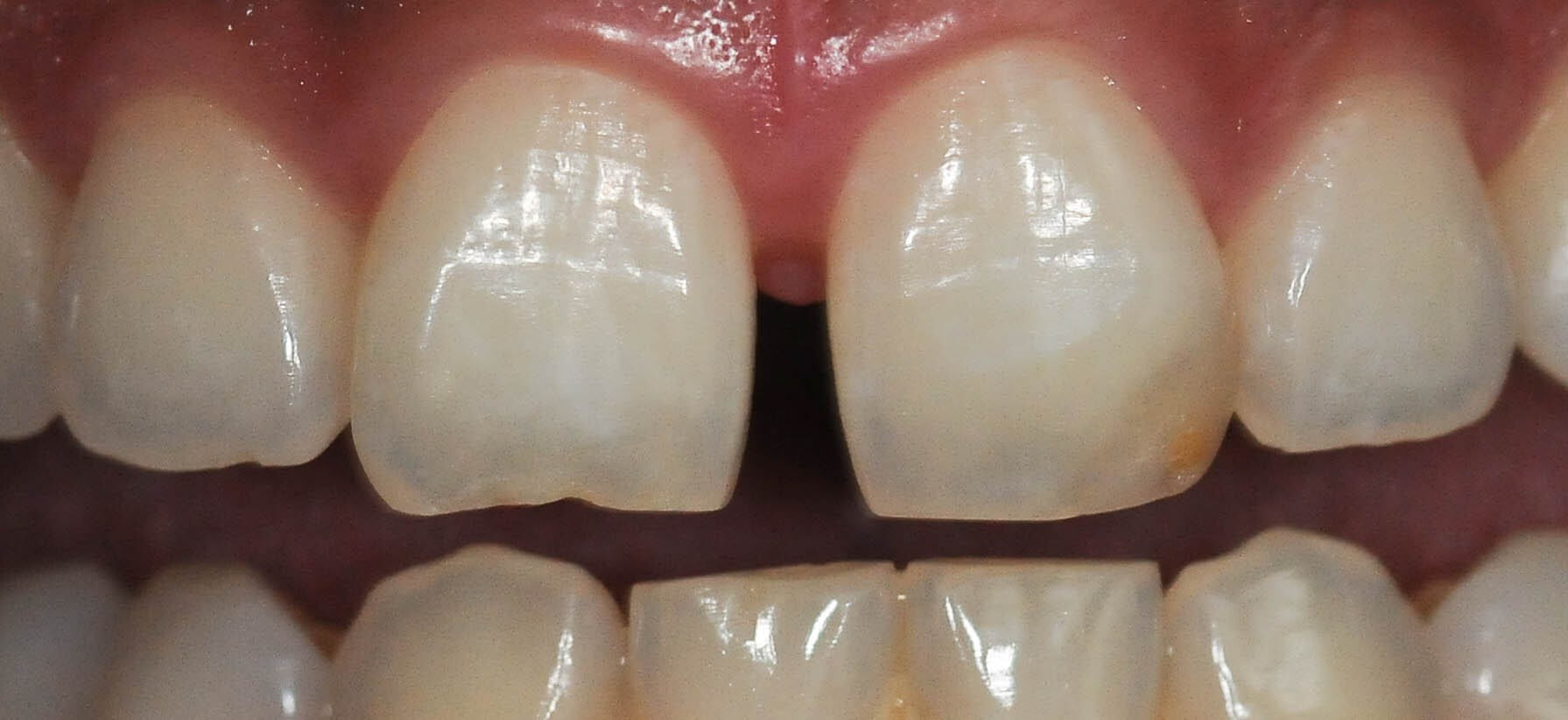 Before Image