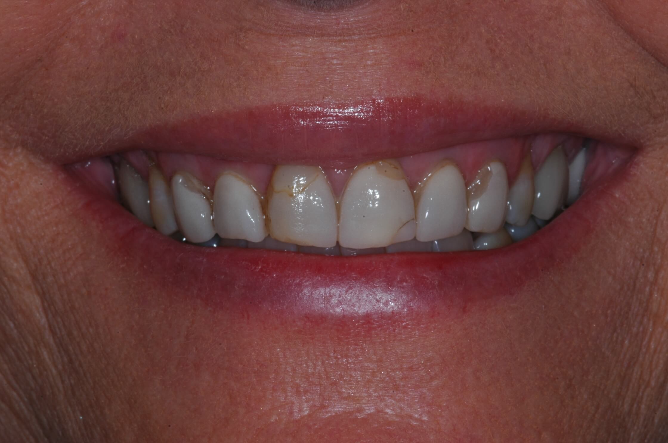 Before Image