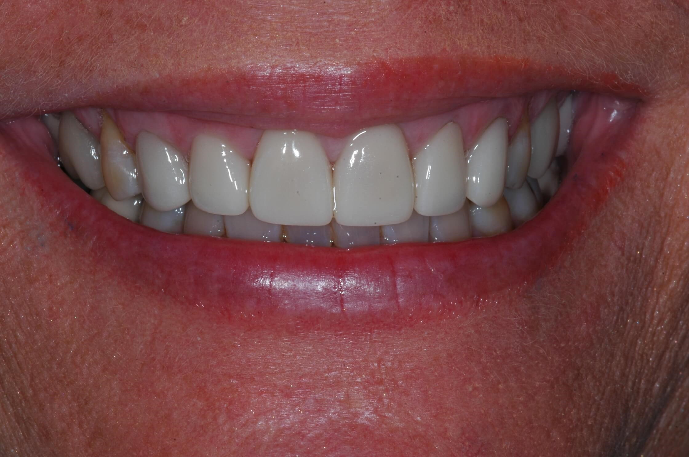 After Image
