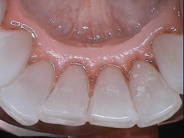 After Image