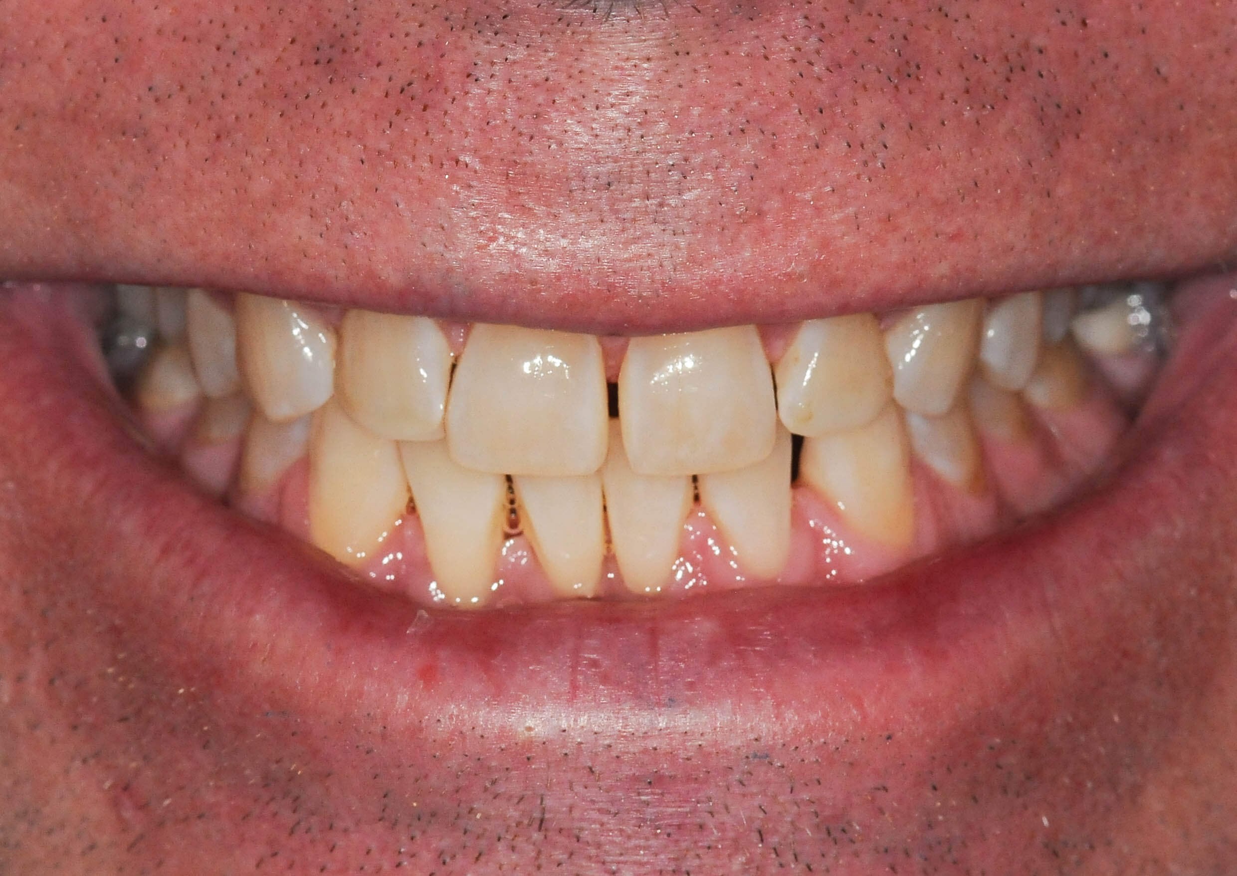 Before Image