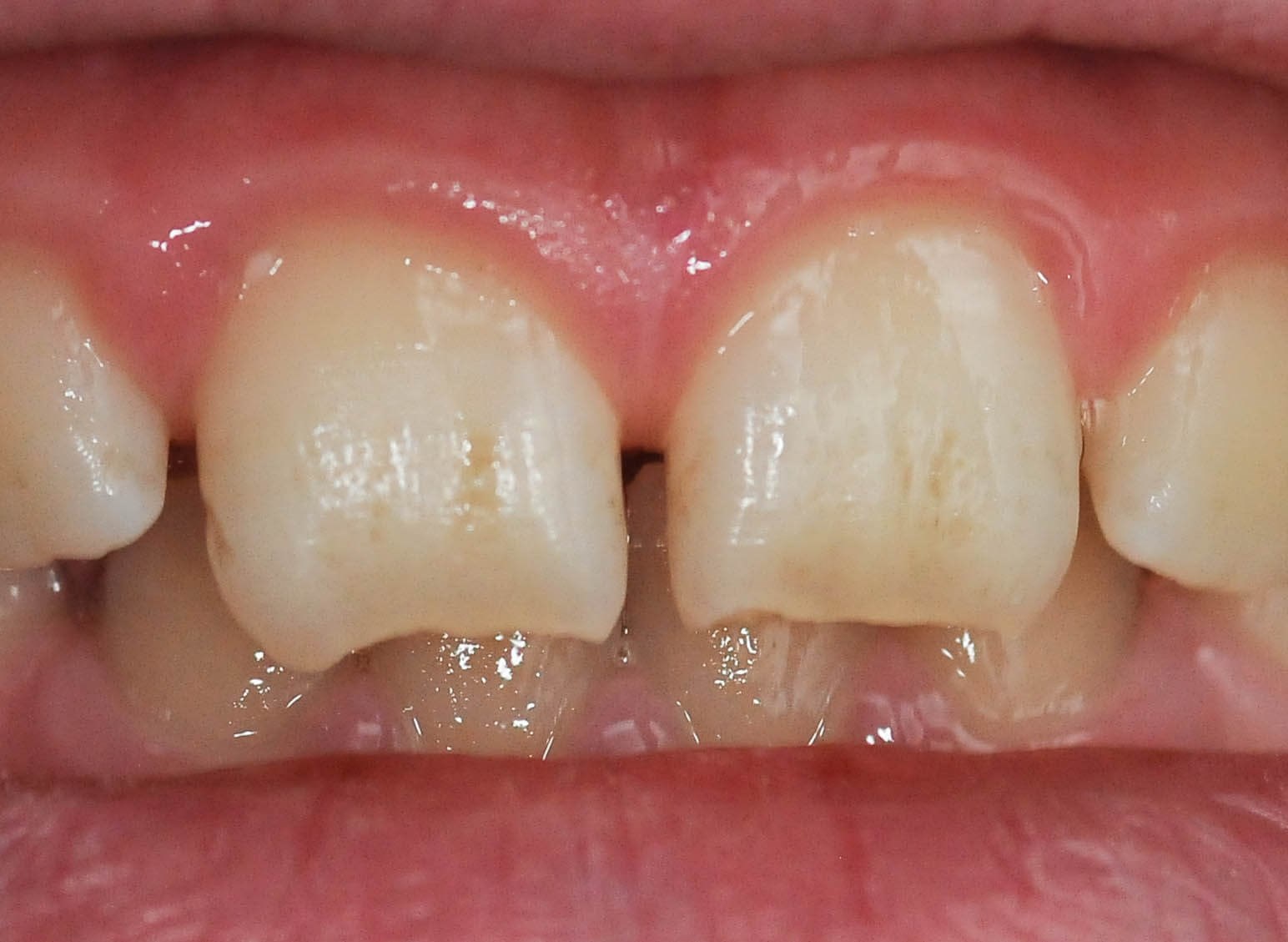 Before Image
