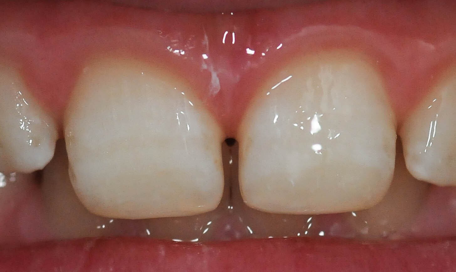 After Image