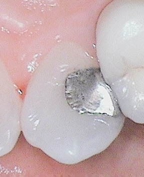 Before Image
