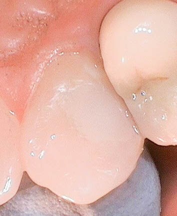 After Image