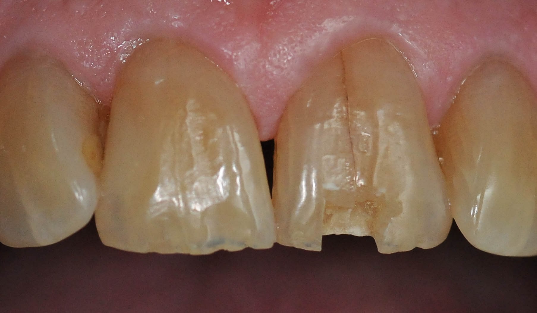 Before Image