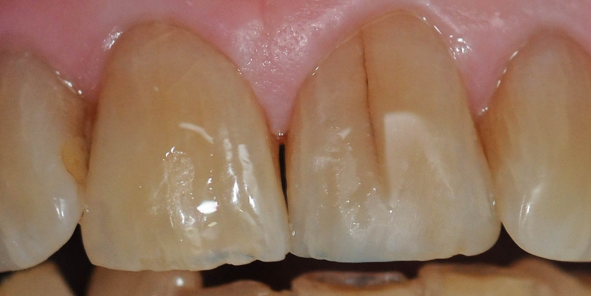 After Image