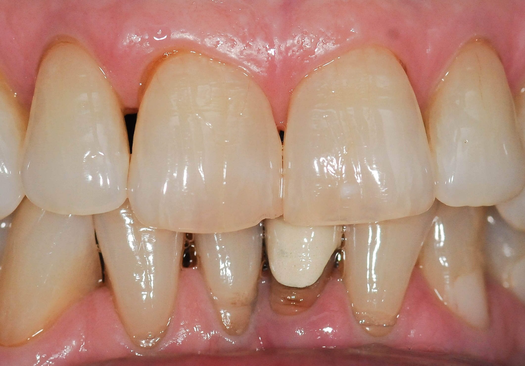 Before Image
