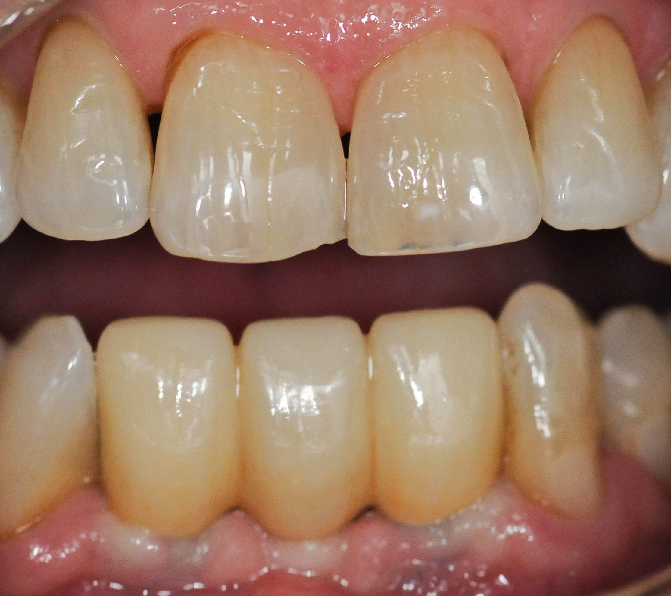 After Image