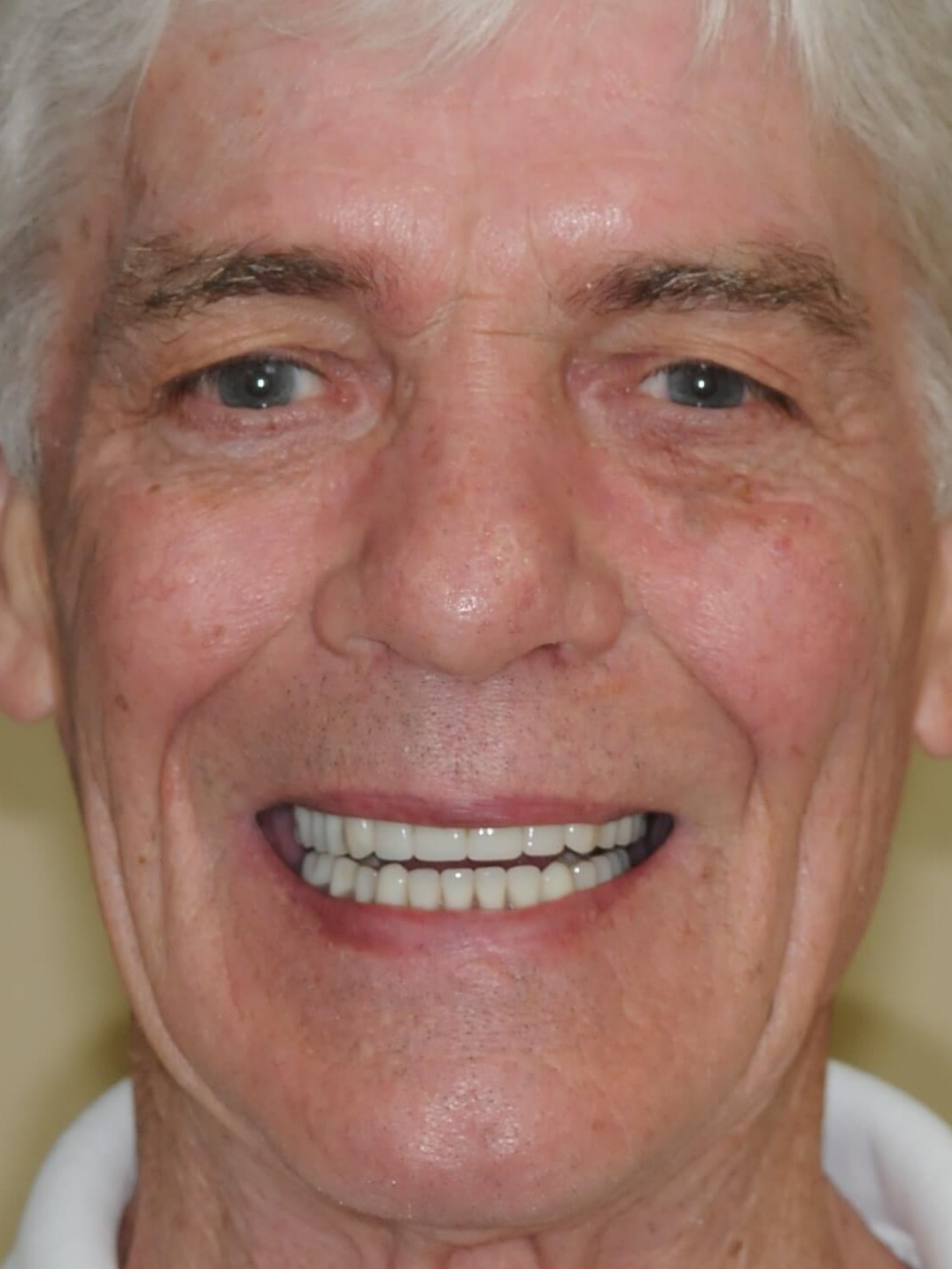 Amazing New And Natural Teeth After
