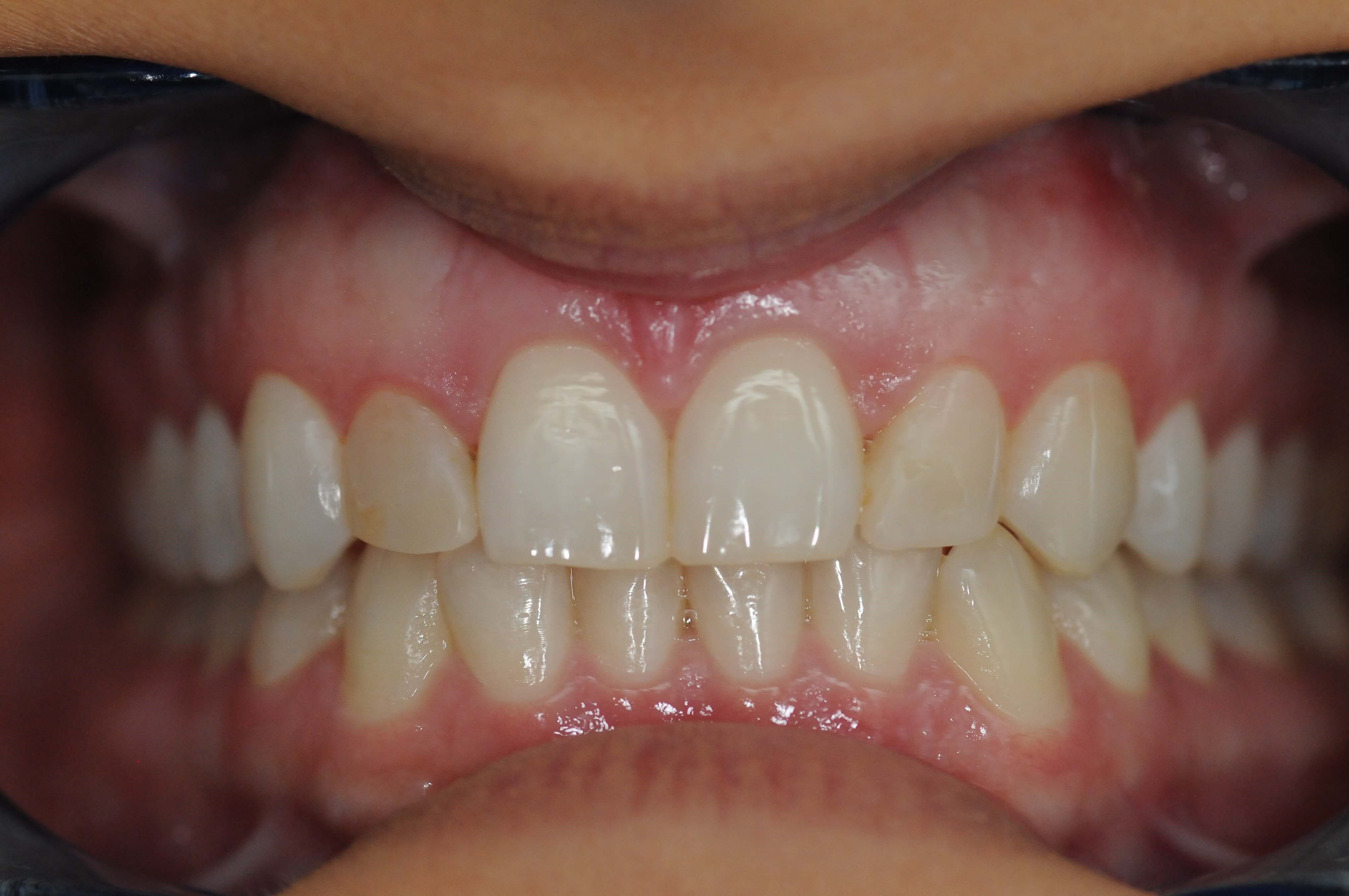 Before Image