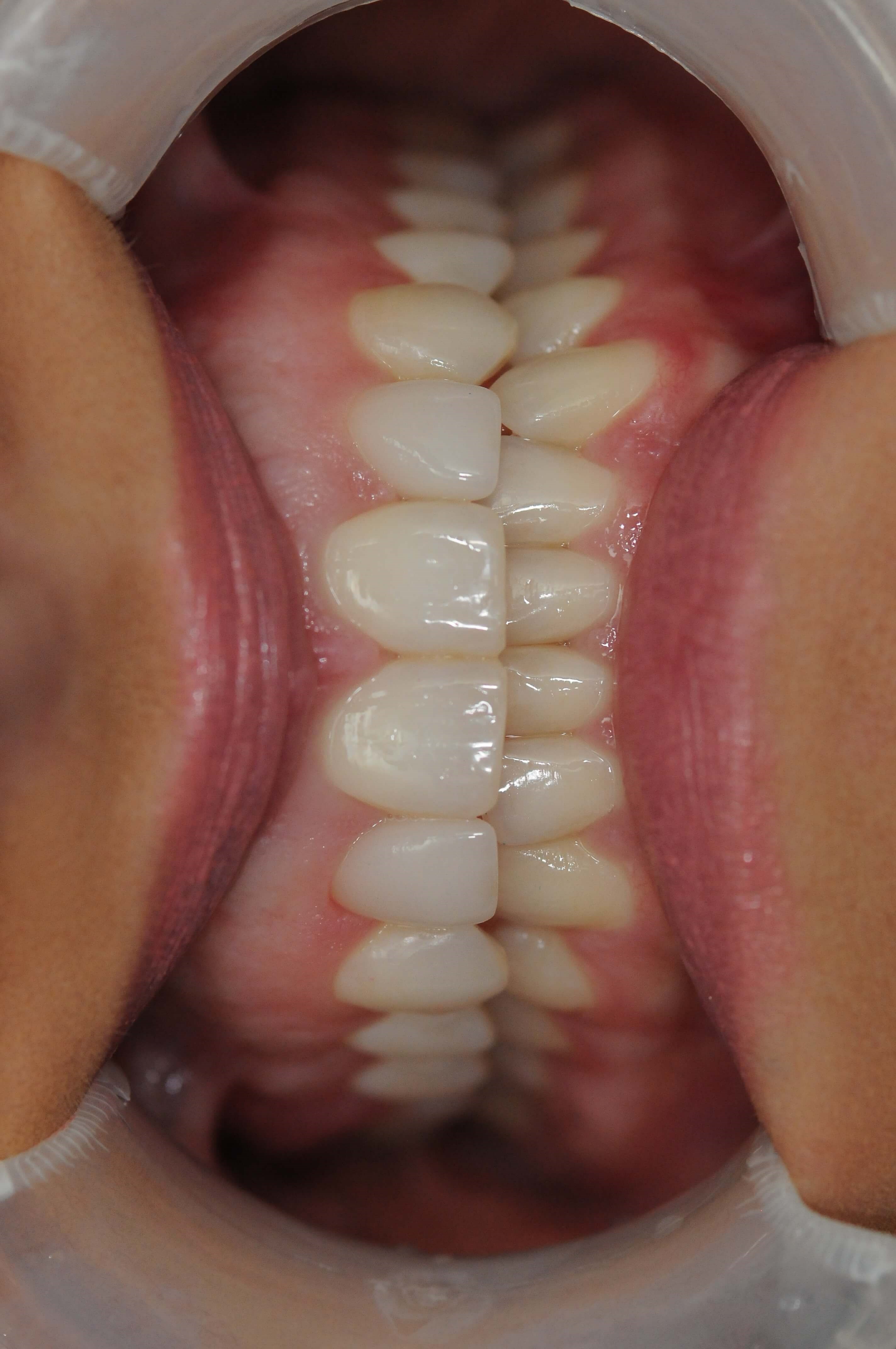 After Image