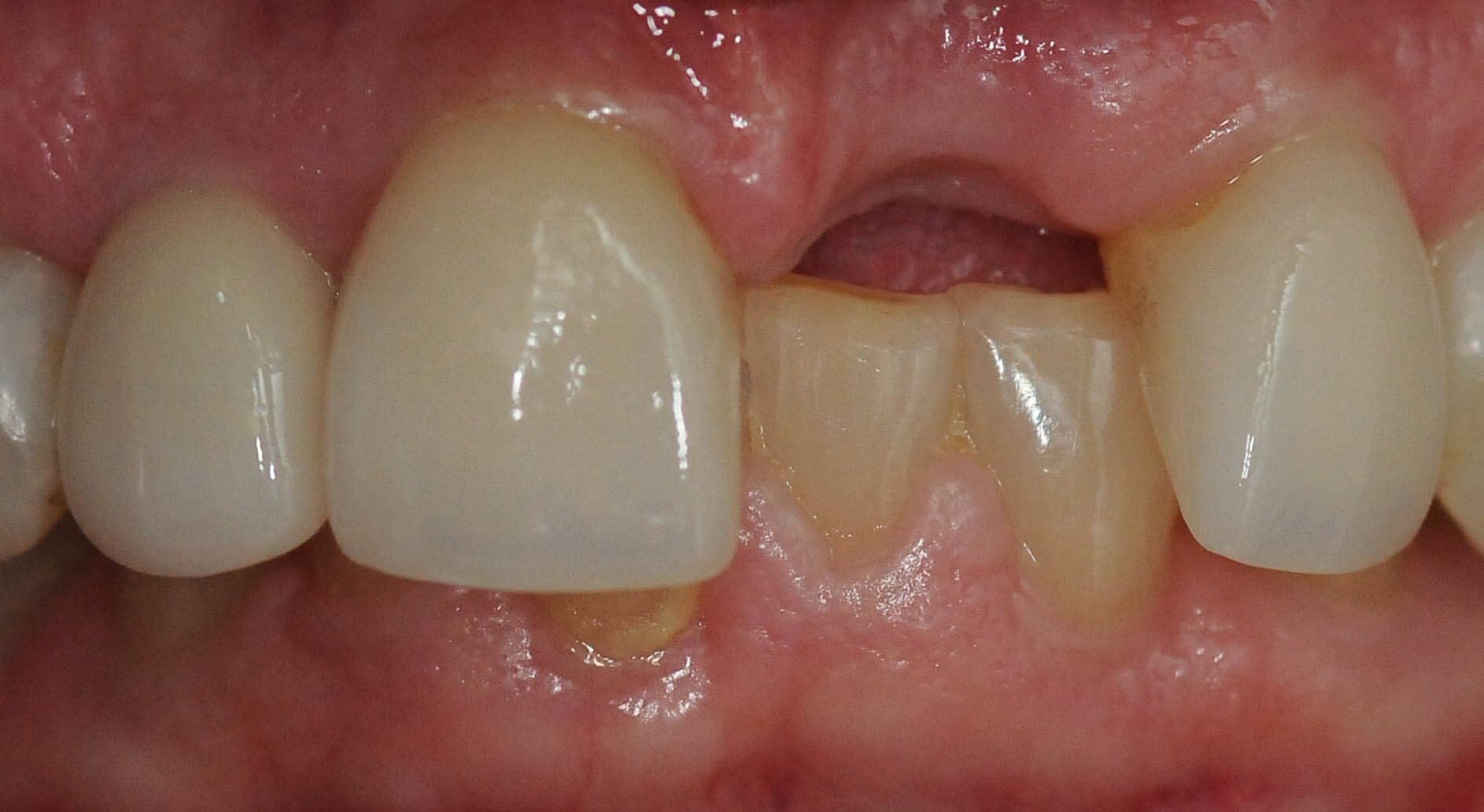 Before Image