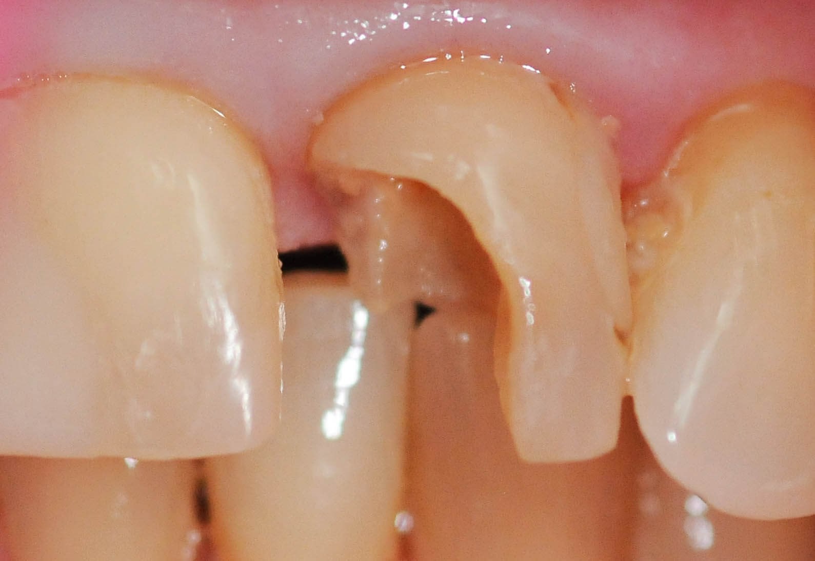 Before Image