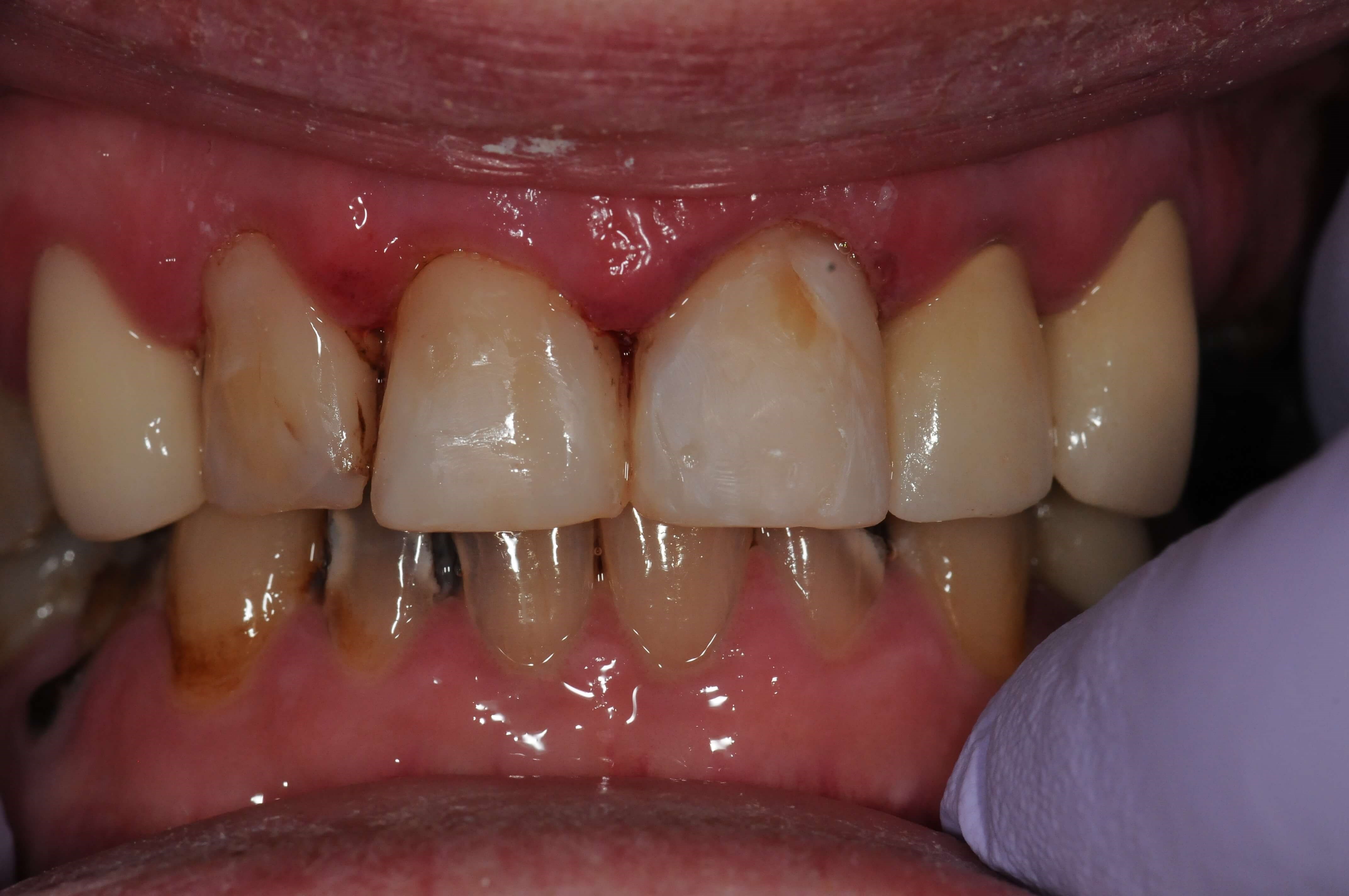 Before Image