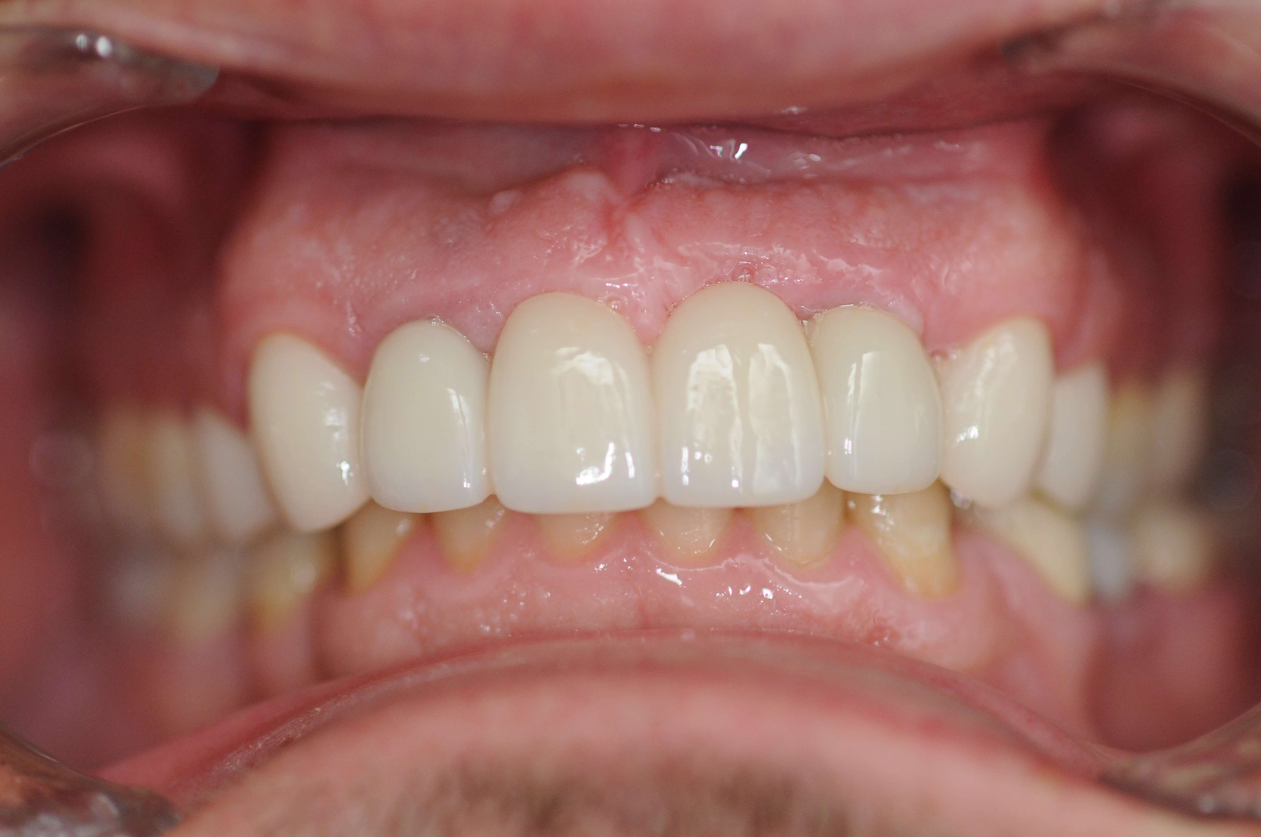 After Image
