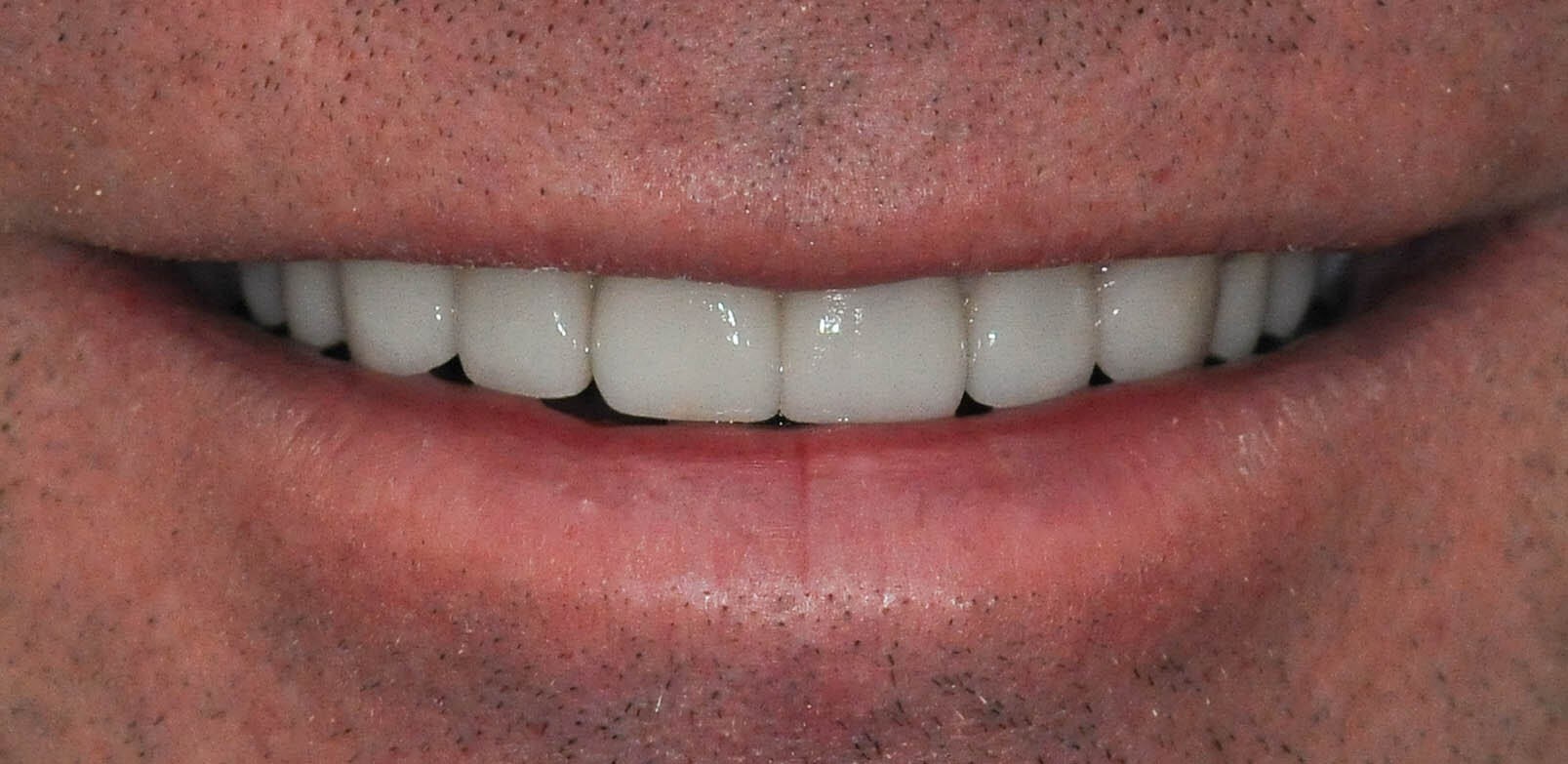 After Image