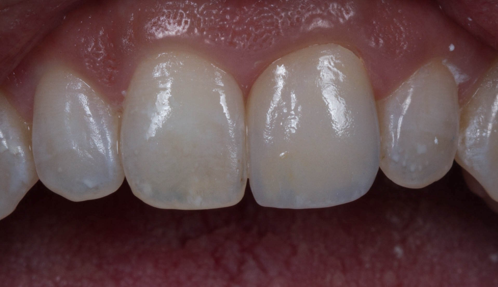 After Image