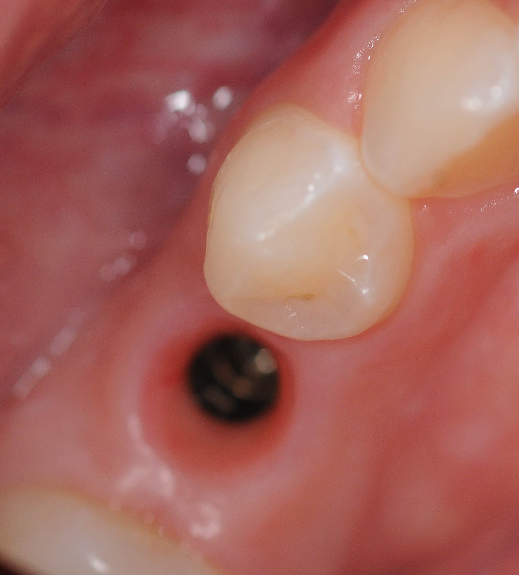 Before Image