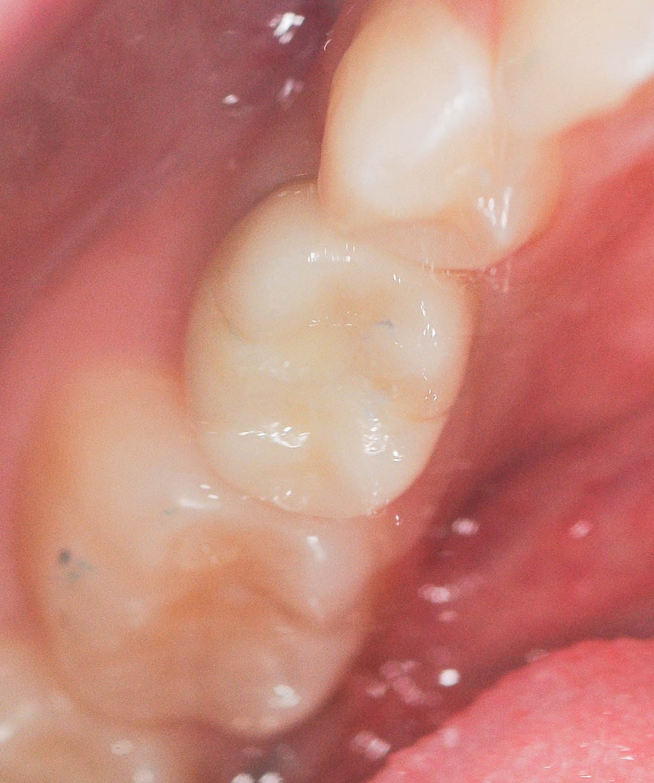 After Image