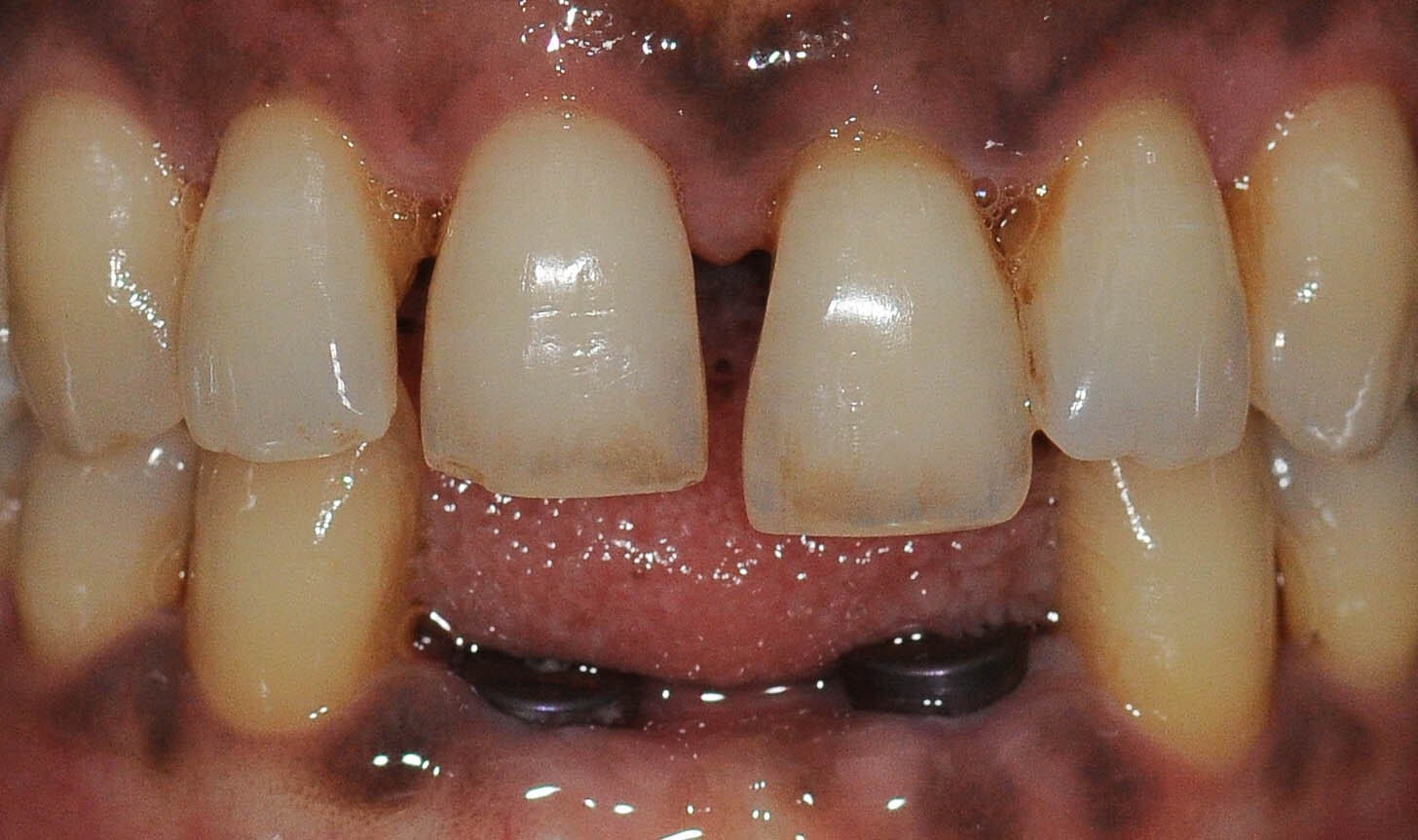 Before Image