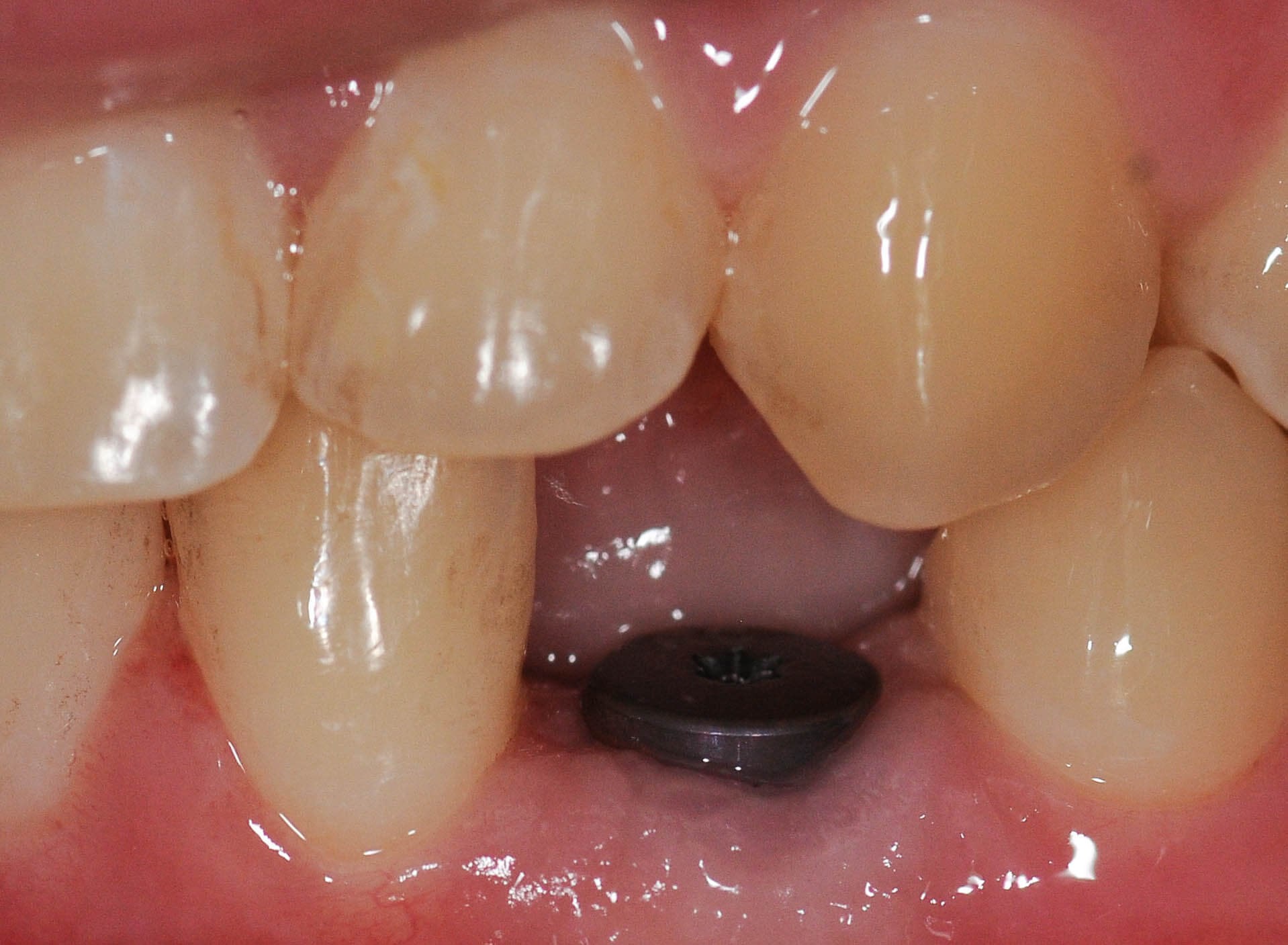 Before Image