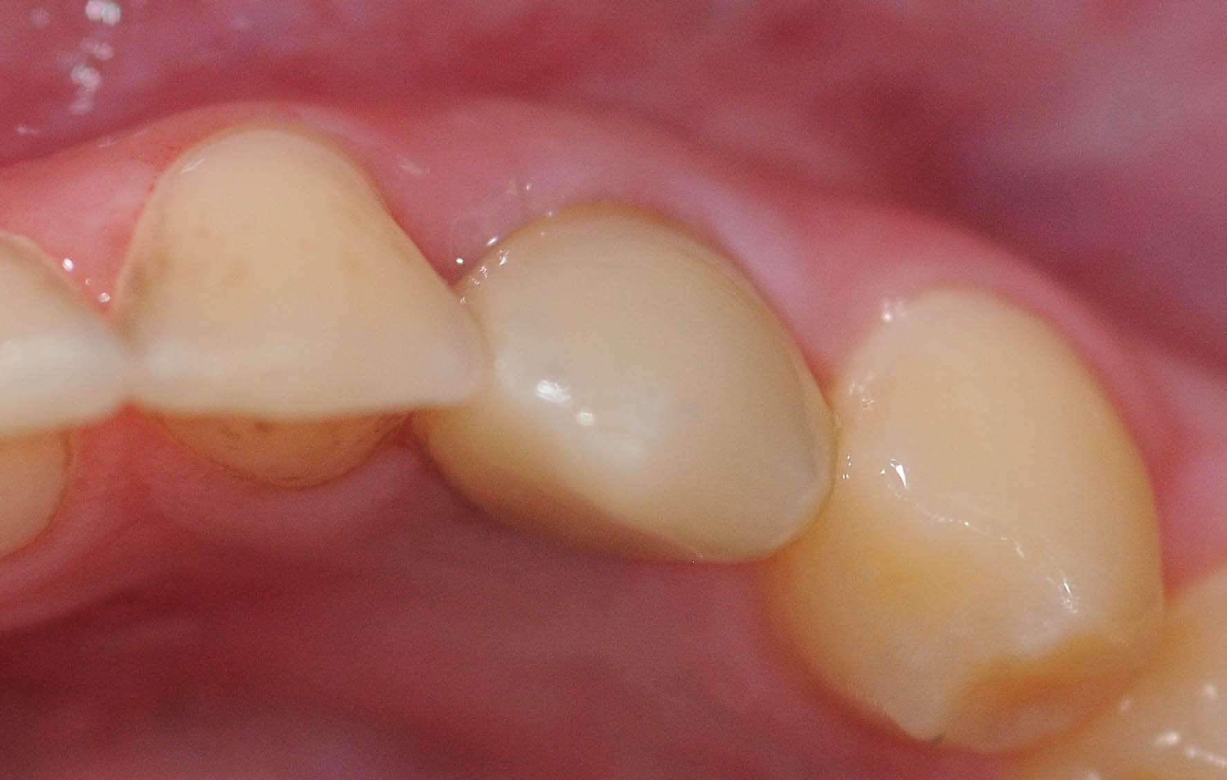After Image