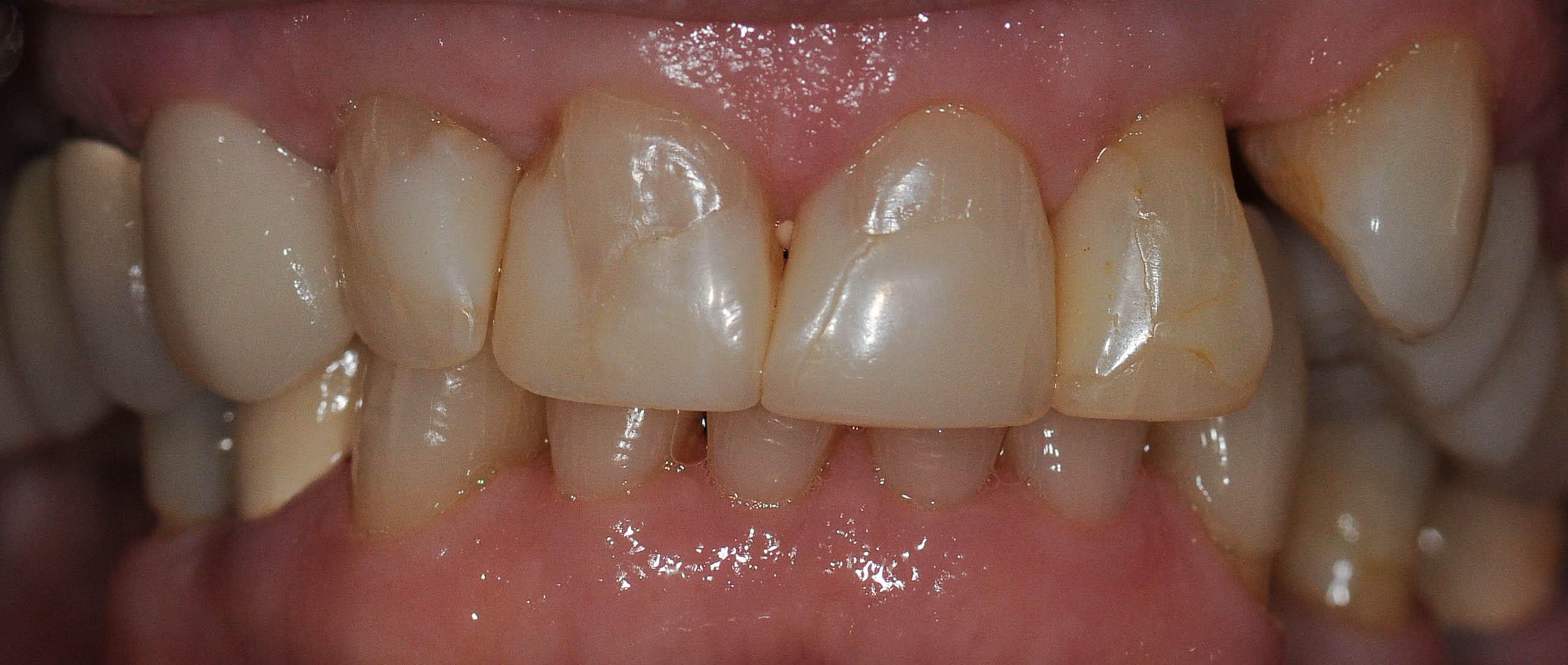 Before Image
