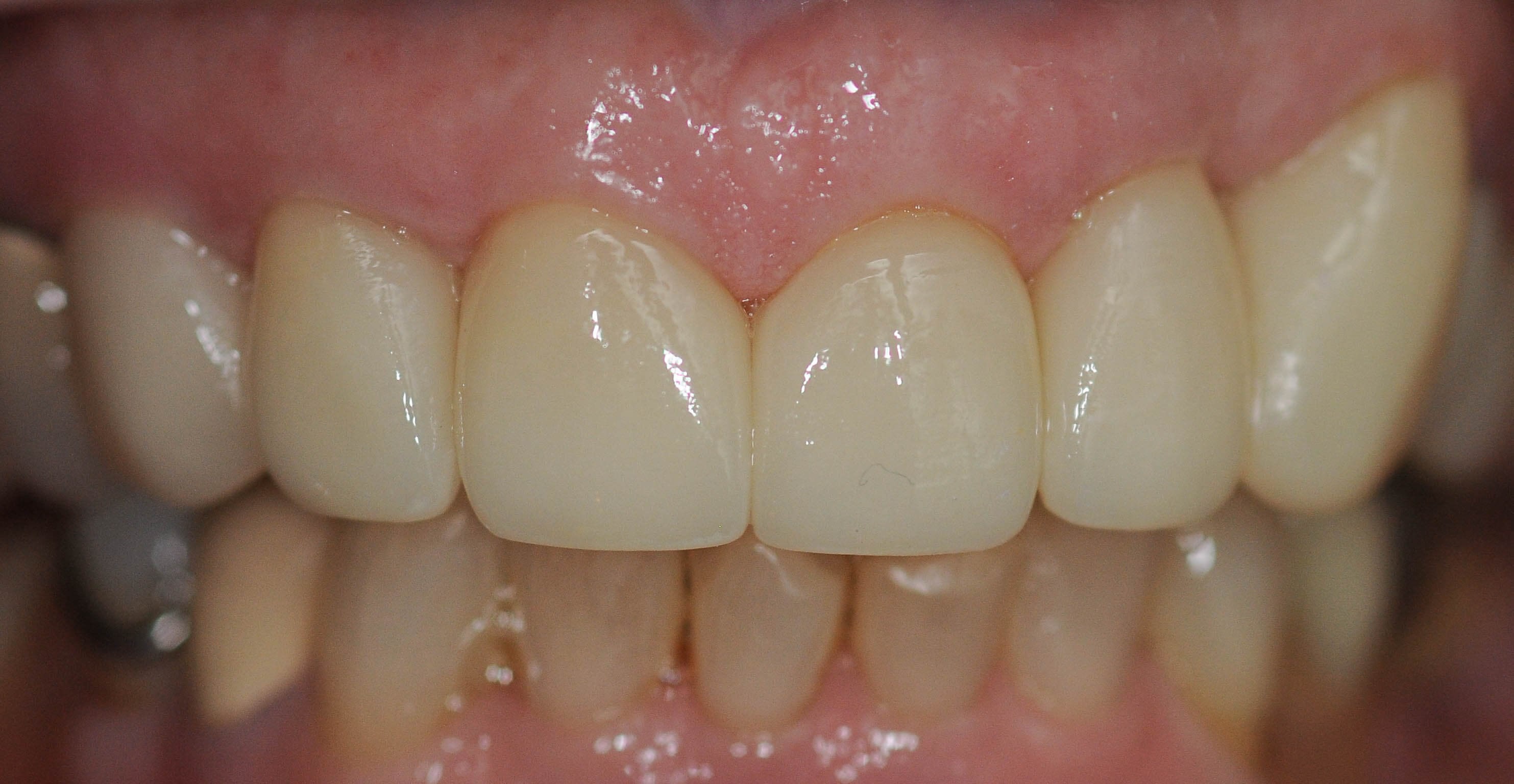 After Image