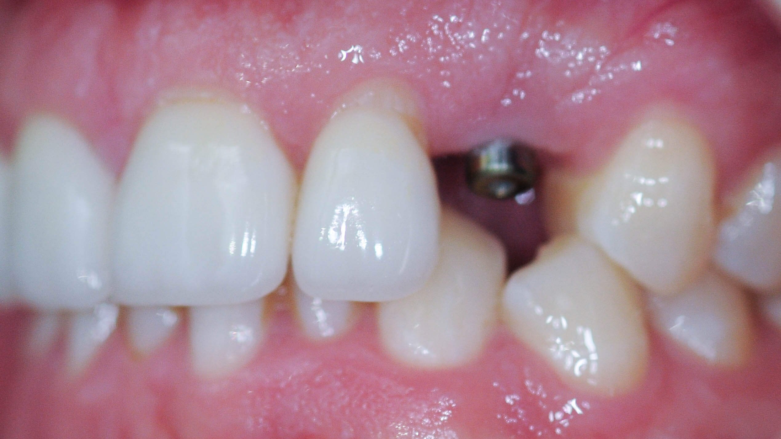 Before Image