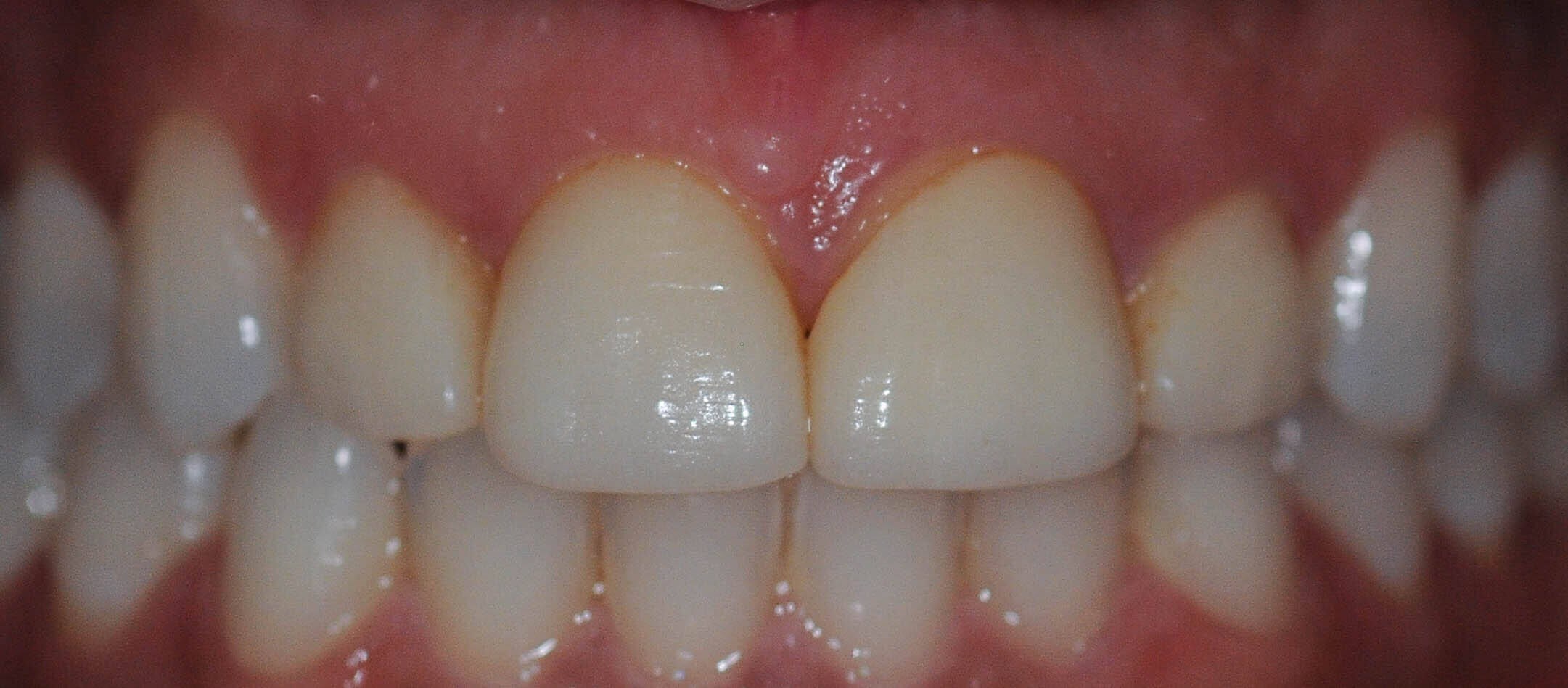 Before Image